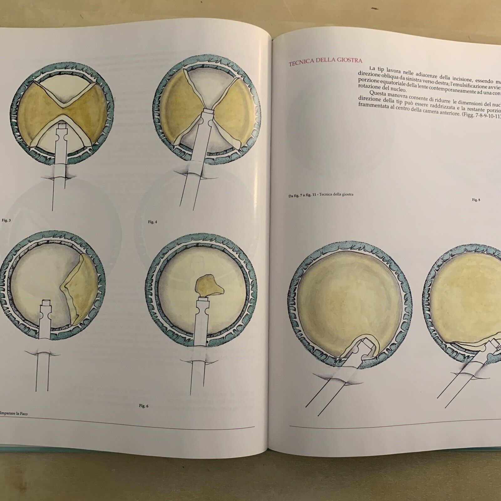 IMPARARE LA FACO - DAL FIUME E. , TASSINARI G. - FOGLIAZZA EDITORE 1992