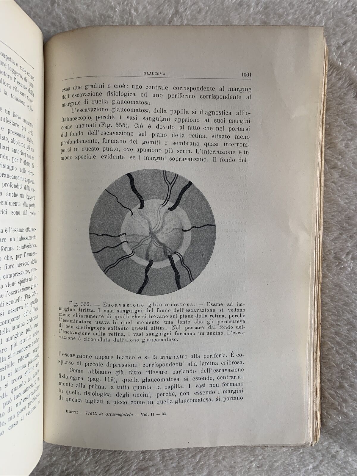TRATTATO DI OFTALMOJATRIA. Amilcare Bietti, Vol. secondo puntata prima-seconda.