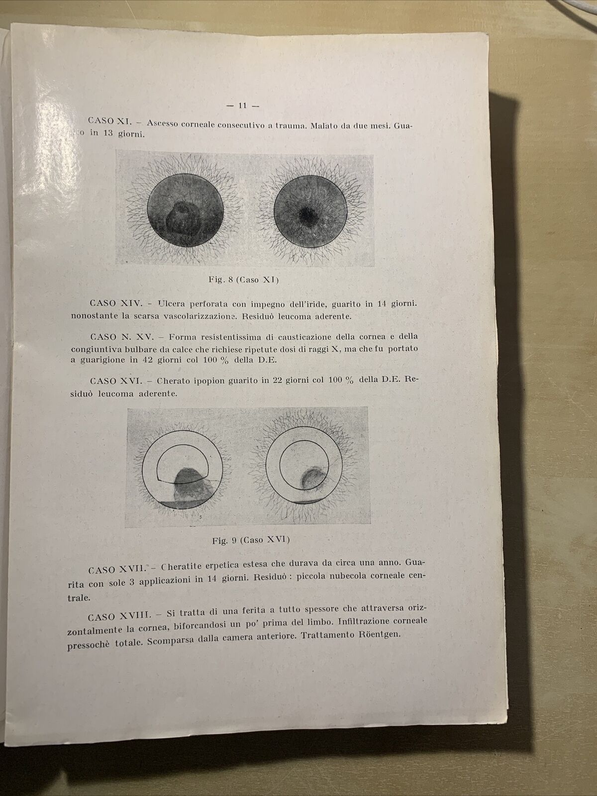 SAGGI DI OFTALMOLOGIA - clinica oculistica di Roma. Prof di Marzio 1927. vol 3 #