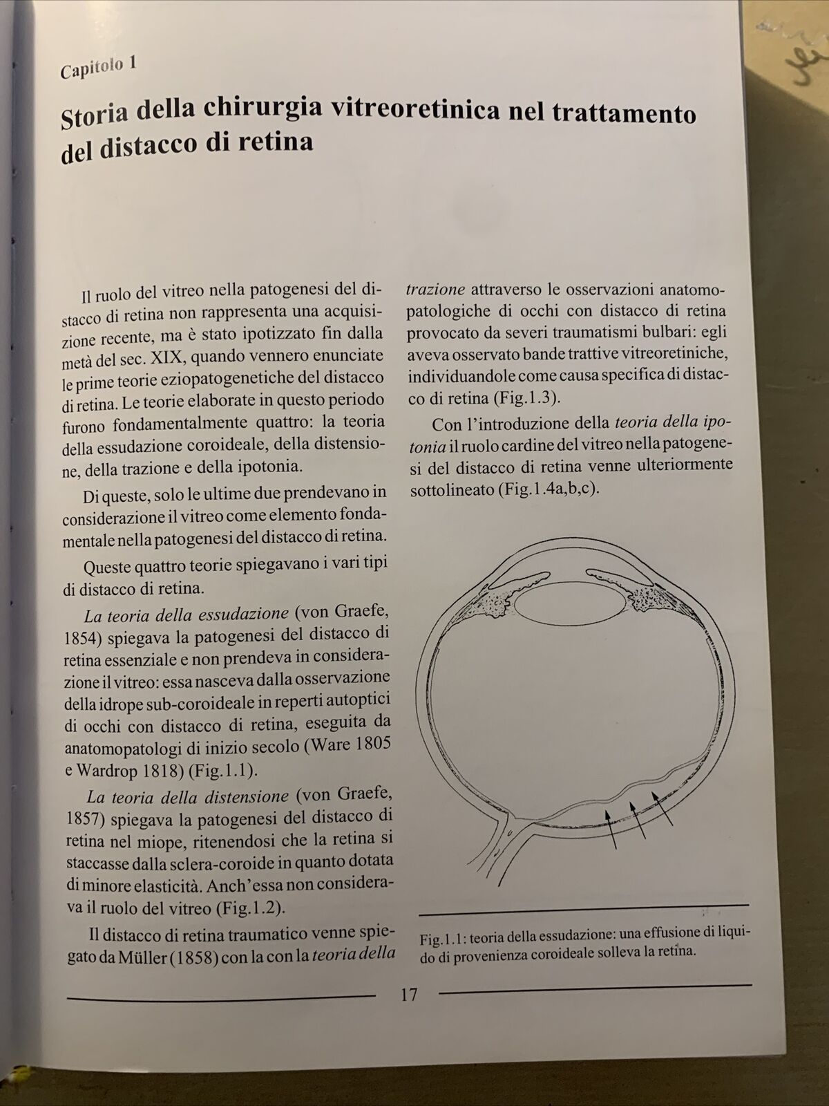 LA CHIRURGIA VITREORETINICA NEL DISTACCO DI RETINA REGMATOGENO. Molfetta Ghedini