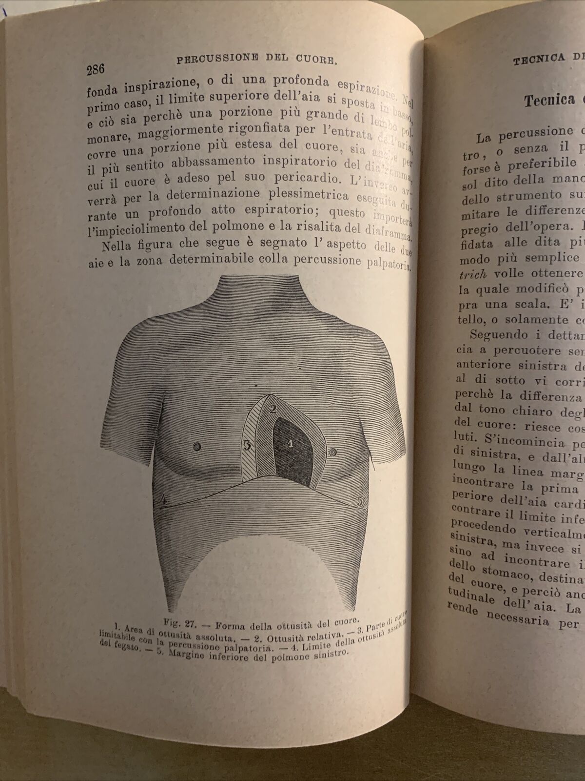 MANUALE DI CLINICA MEDICA PROPEDEUTICA (SEMEIOTICA) Adolfo Biondi, Vallardi 1903