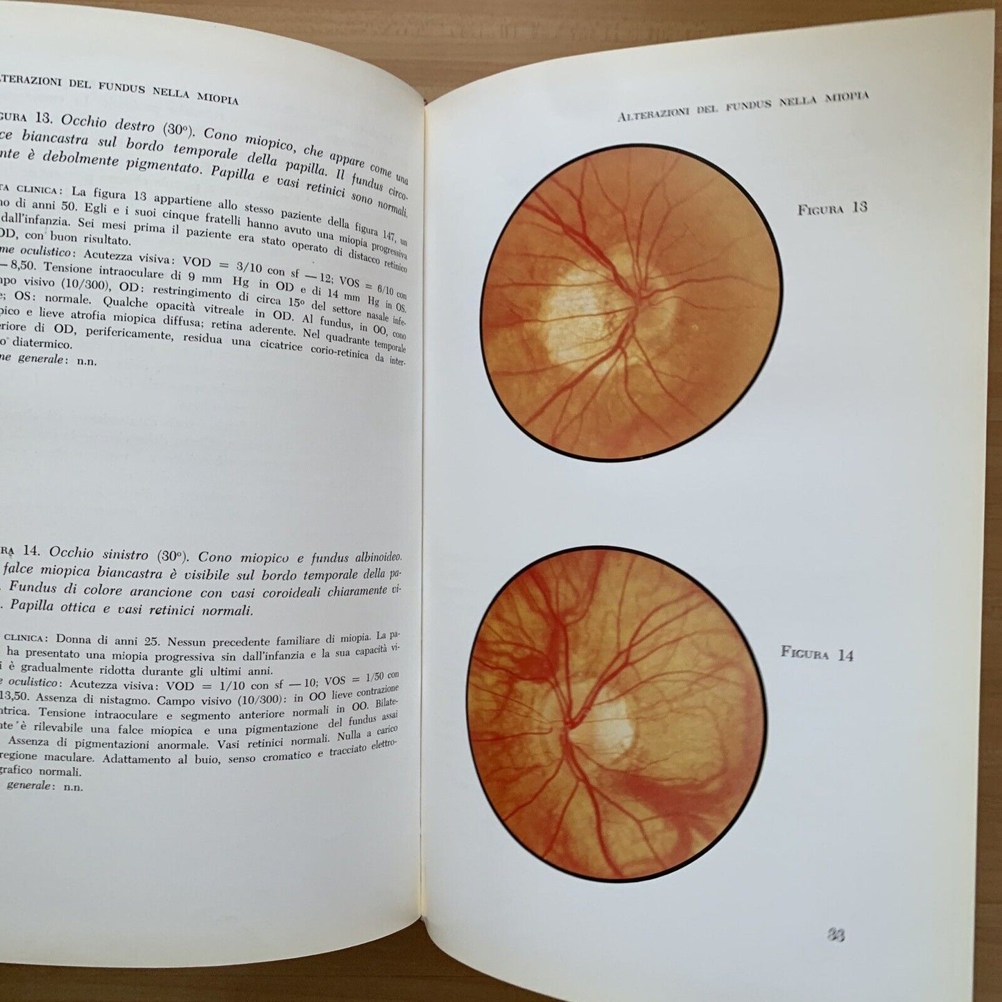 ATLANTE DEL FONDO DELL'OCCHIO - H. W. LARSEN. Luigi Russo editore 1964