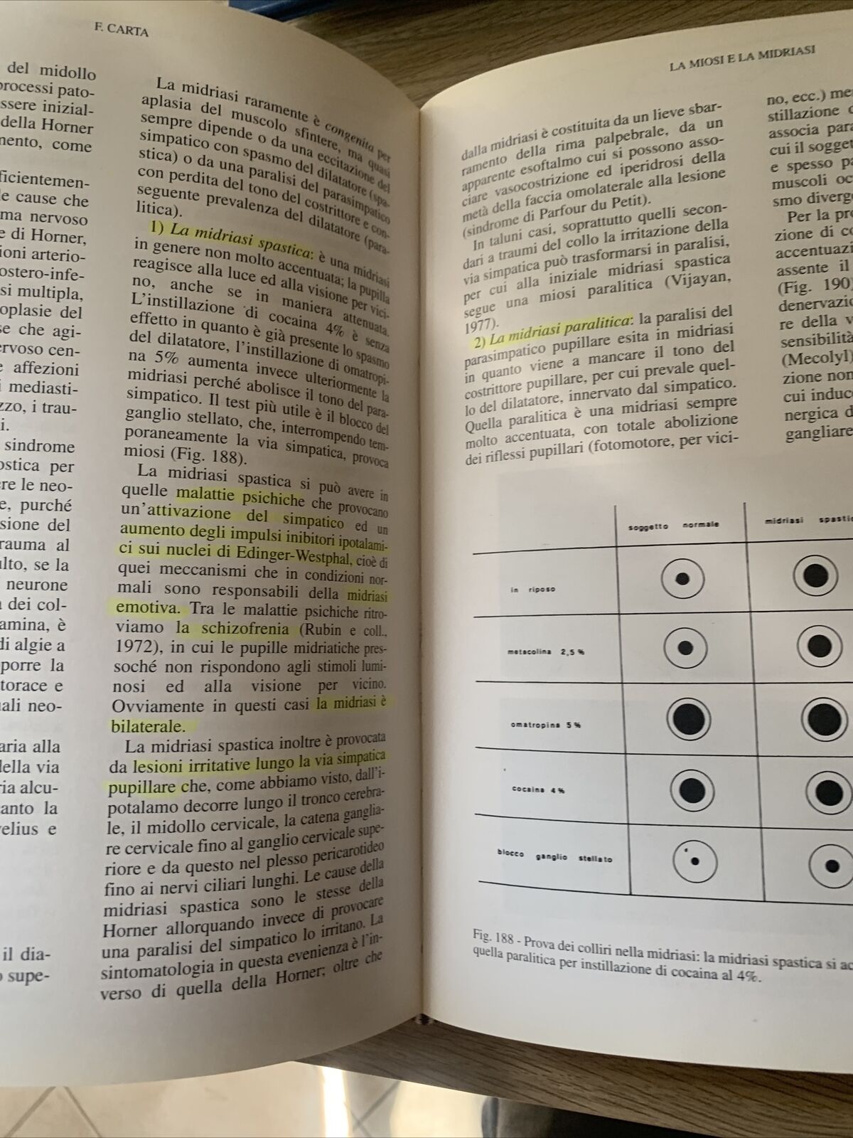 NEUROFTALMOLOGIA - FRANCESCO CARTA, EDIZIONI SBM 1997 #