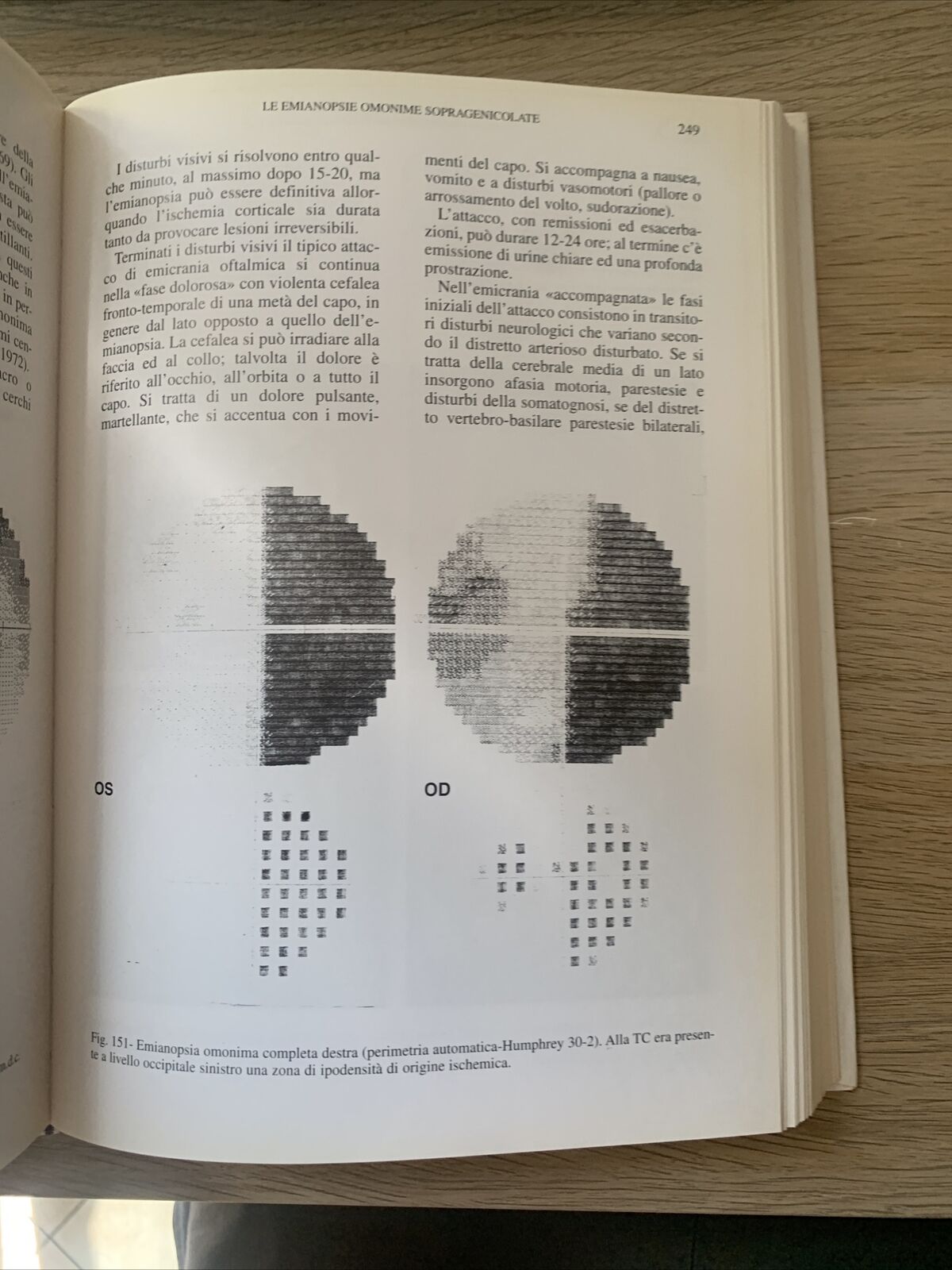 NEUROFTALMOLOGIA - FRANCESCO CARTA, EDIZIONI SBM 1997 #