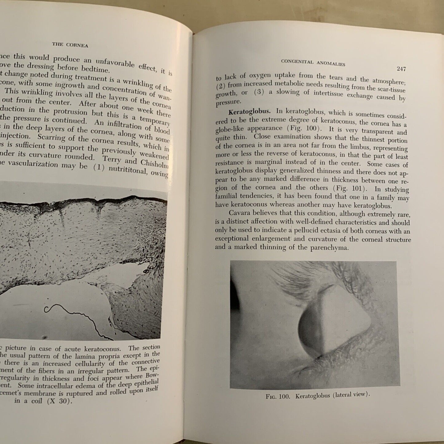 THE CORNEA - CHARLES THOMAS M. D.
