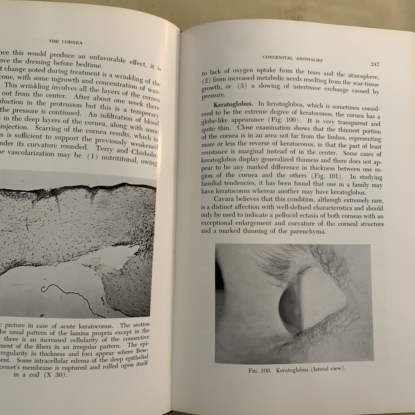 THE CORNEA - CHARLES THOMAS M. D.