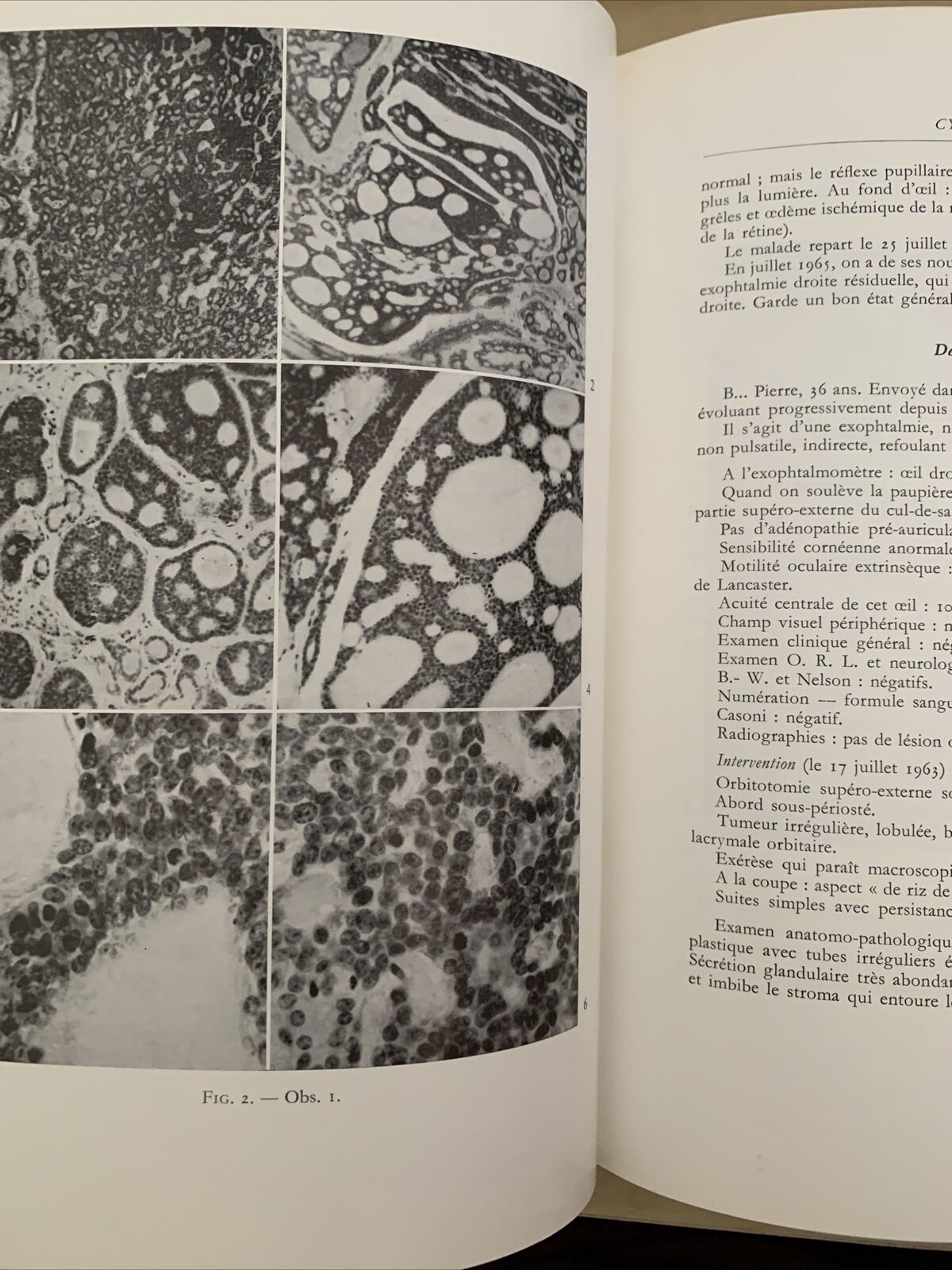 TRAVAUX D'OPHTALMOLOGIE MODERNE - Mawas Jacques - Masson et Cie 1966 #