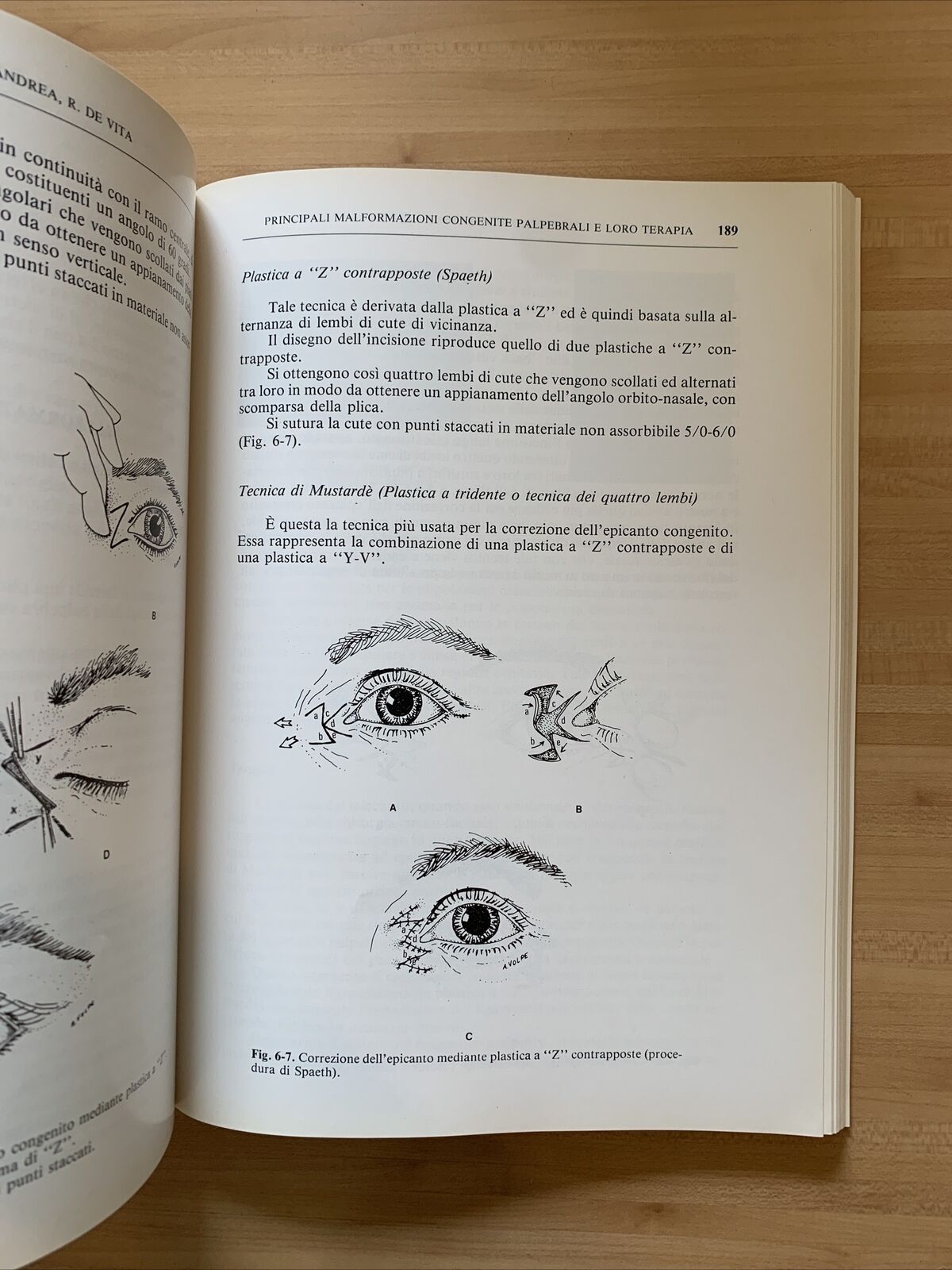 MALATTIE CONGENITE DELL'APPARATO OCULARE - Trattamento chirurgico. G. Scuderi