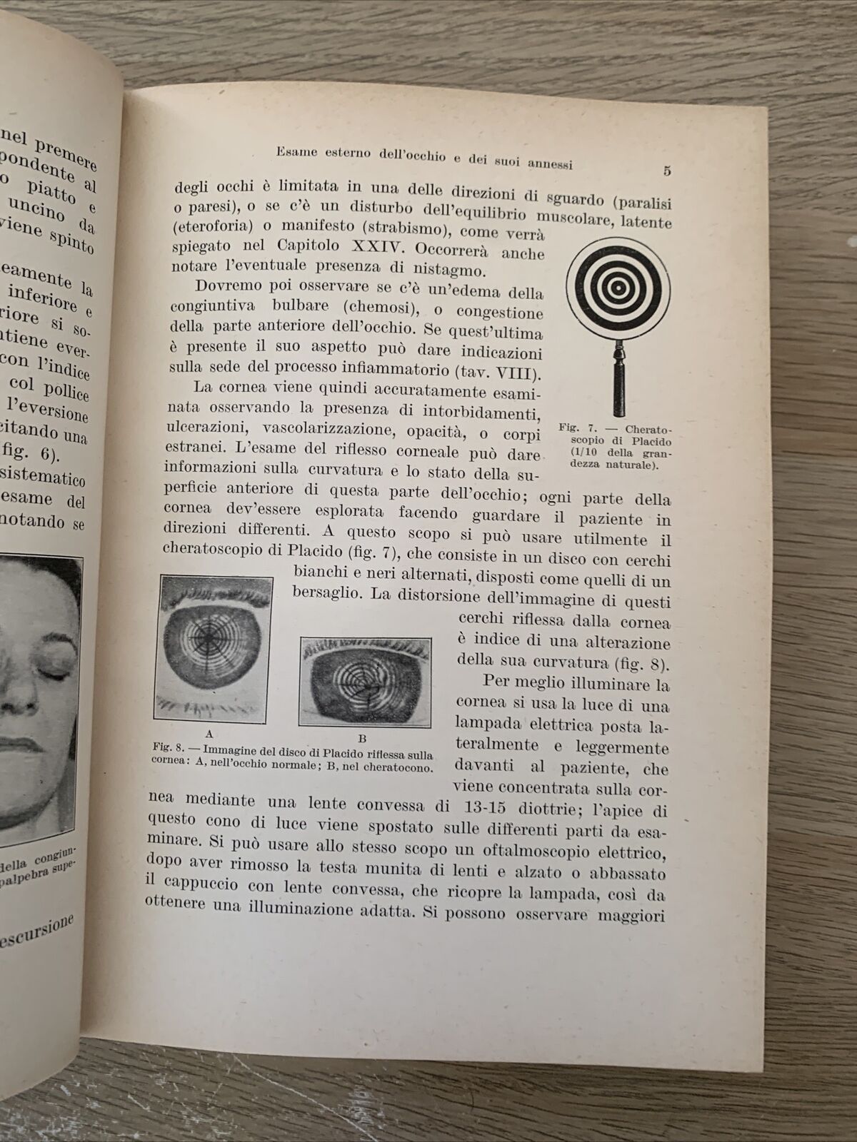 MANUALE DELLE MALATTIE DELL'OCCHIO. CHARLES H. MAY. UTET. per studenti e medici