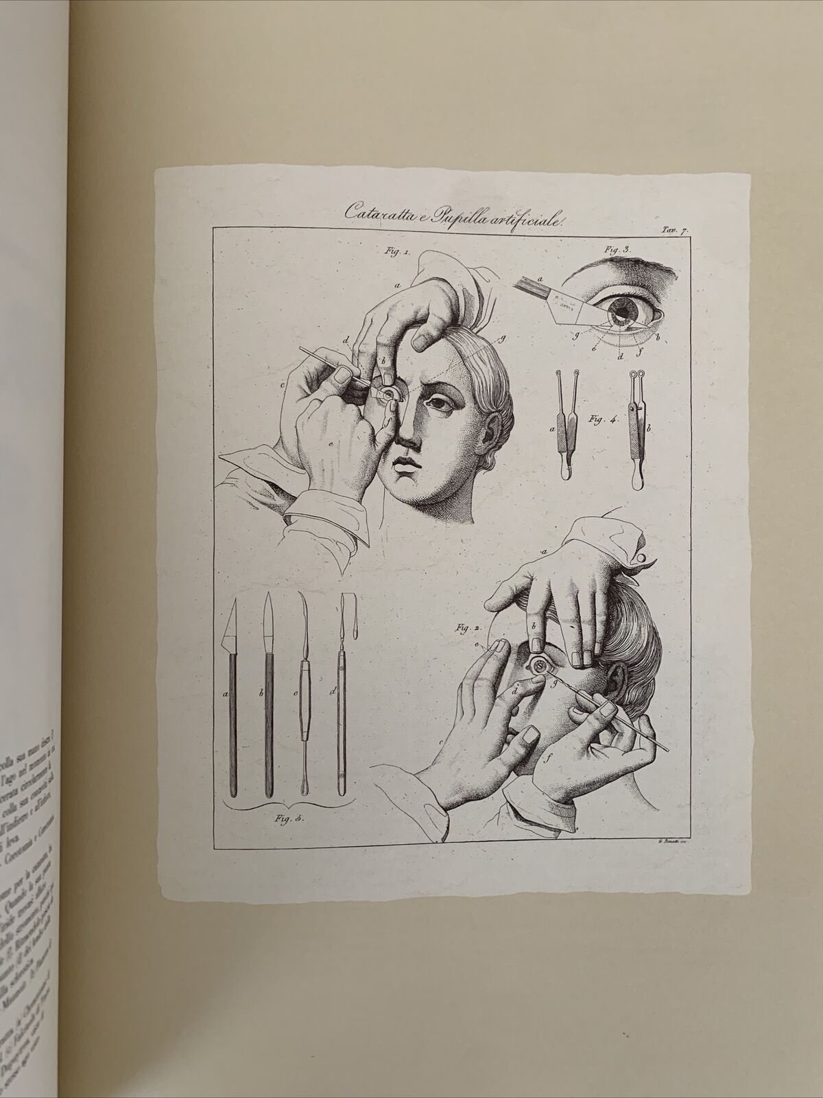 Icones ophthalmologicae - Francesco Loperfido - Casa editrice Mattioli 1992 #
