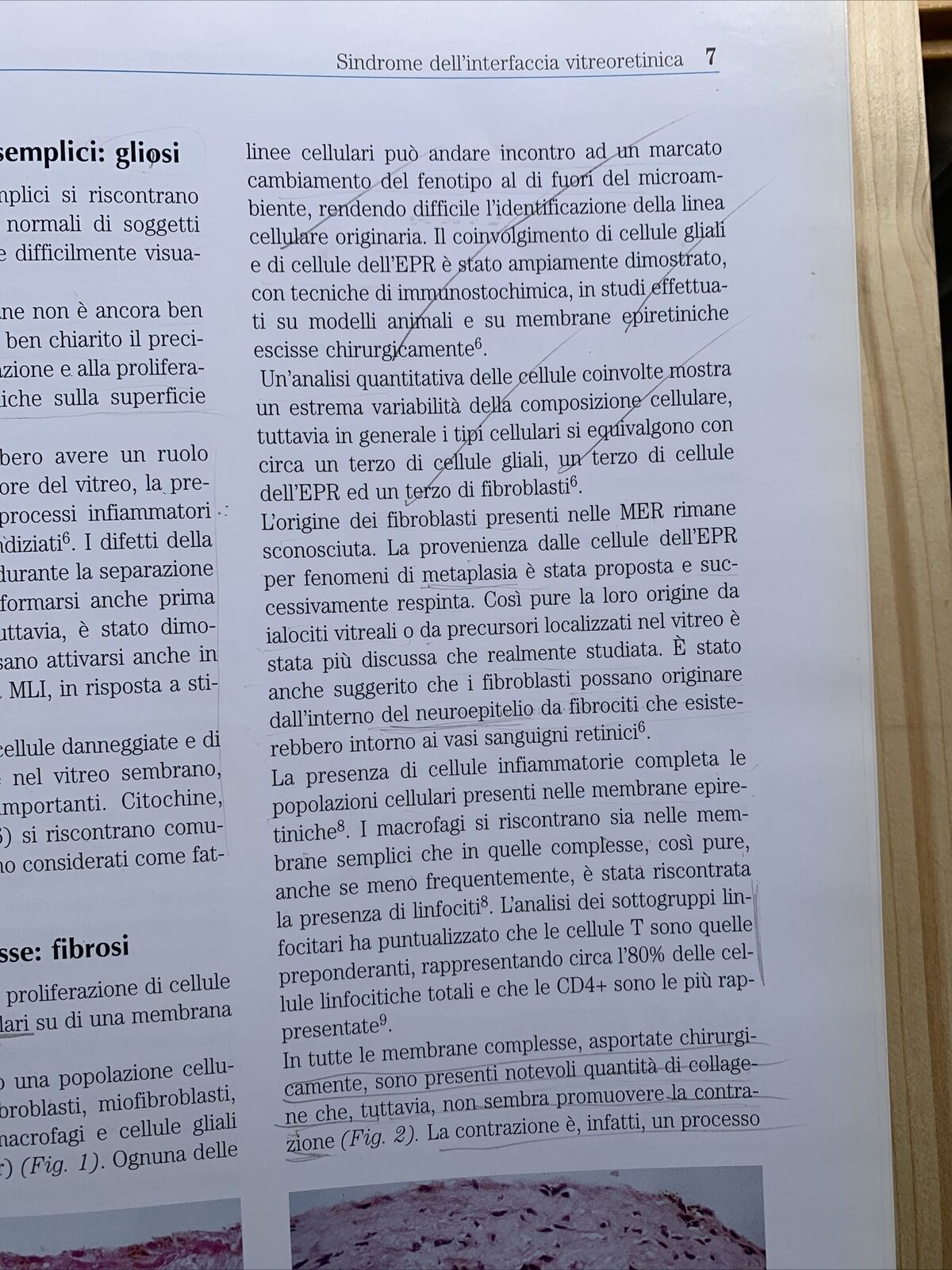 Chirurgia della Macula, Fabiano editore. Società oftalmologica italiana 2001 #