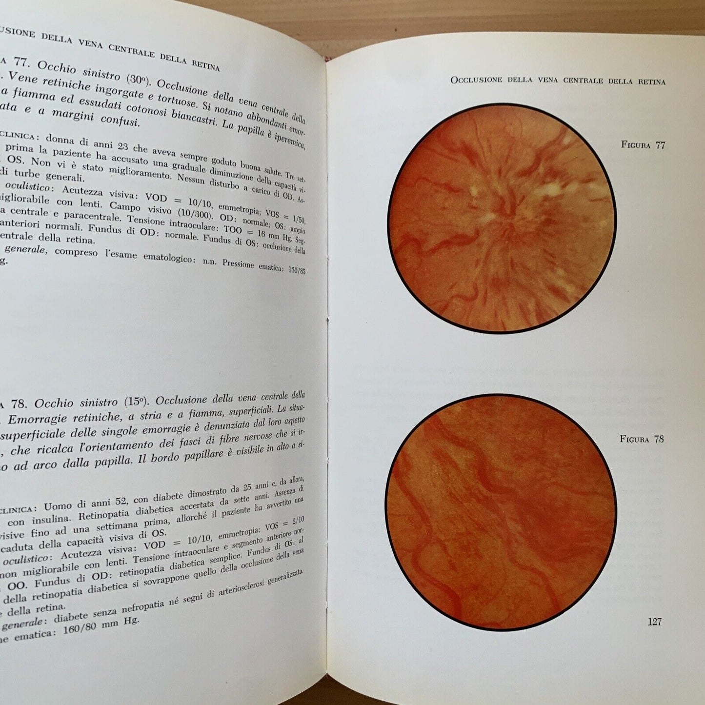ATLANTE DEL FONDO DELL'OCCHIO - H. W. LARSEN. Luigi Russo editore 1964