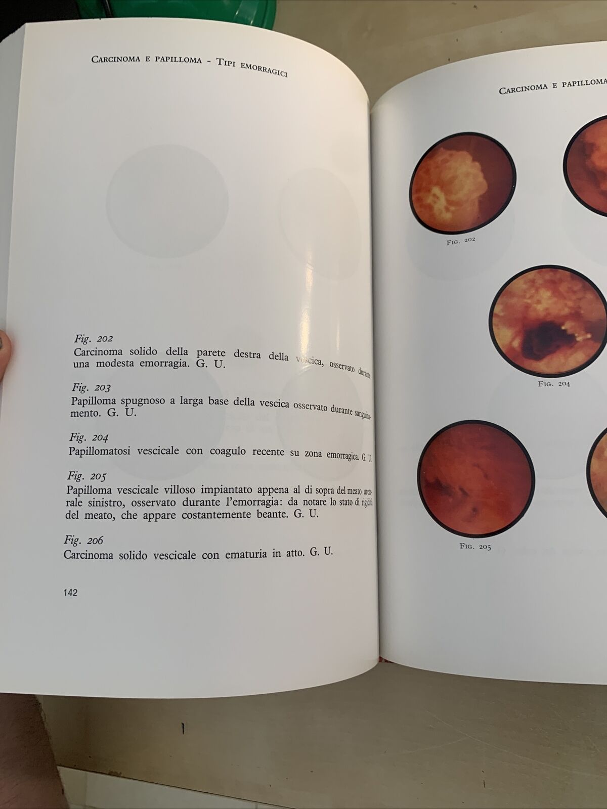 UROLOGIA ENDOSCOPICA - Rocca Rossetti, Usai, Binaghi. Editrice Universo 1970 #