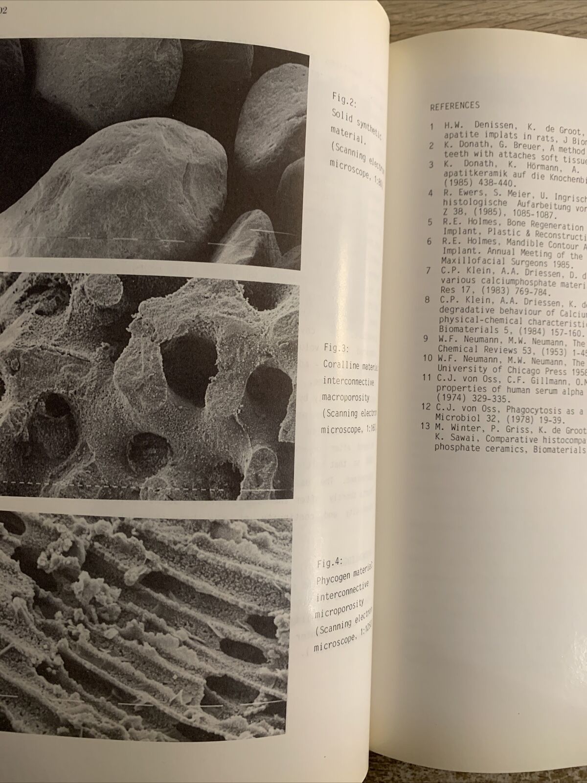 Biomaterials and clinical applications. Pizzoferrato , Marchetti, Ravaglioli.