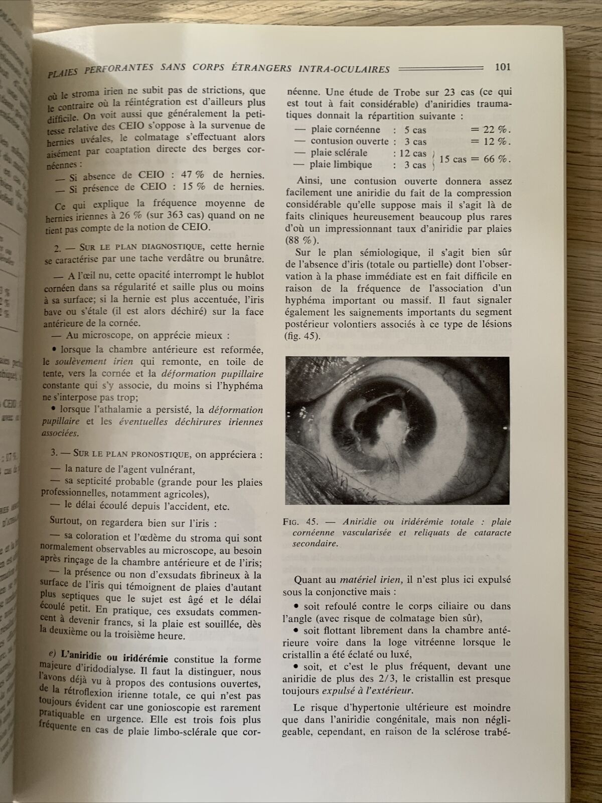 Plaies et contusions du segment anterieur de l'oeil. C. Boudet. Ophtalmologie #