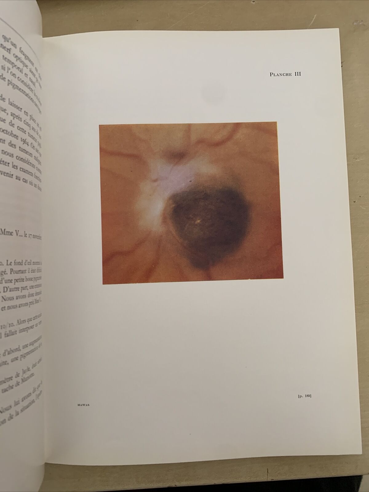 TRAVAUX D'OPHTALMOLOGIE MODERNE - Mawas Jacques - Masson et Cie 1966 #