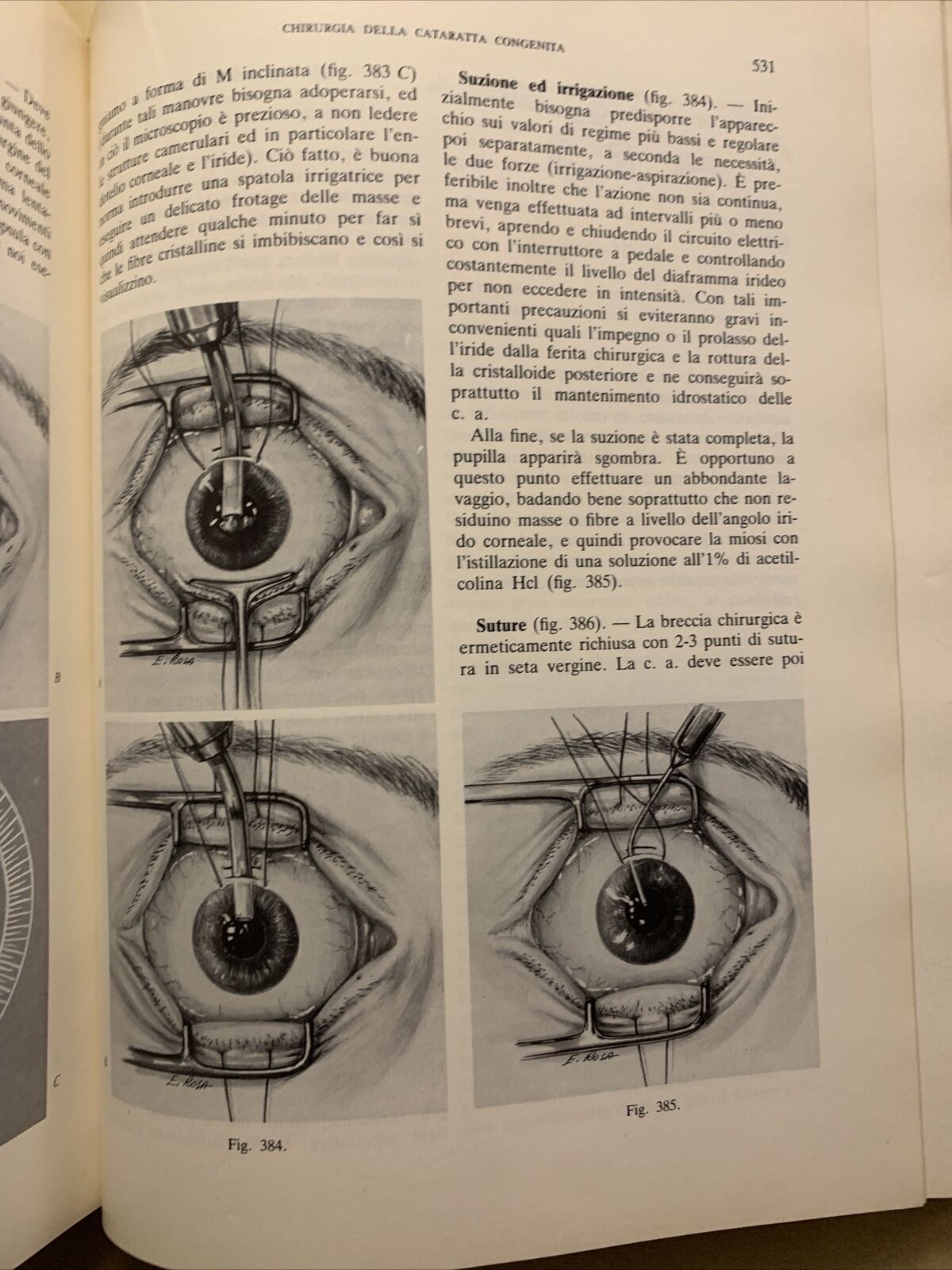 Tecnica Chirurgica. Chirurgia Oculistica UTET volume 10 - 1984 #