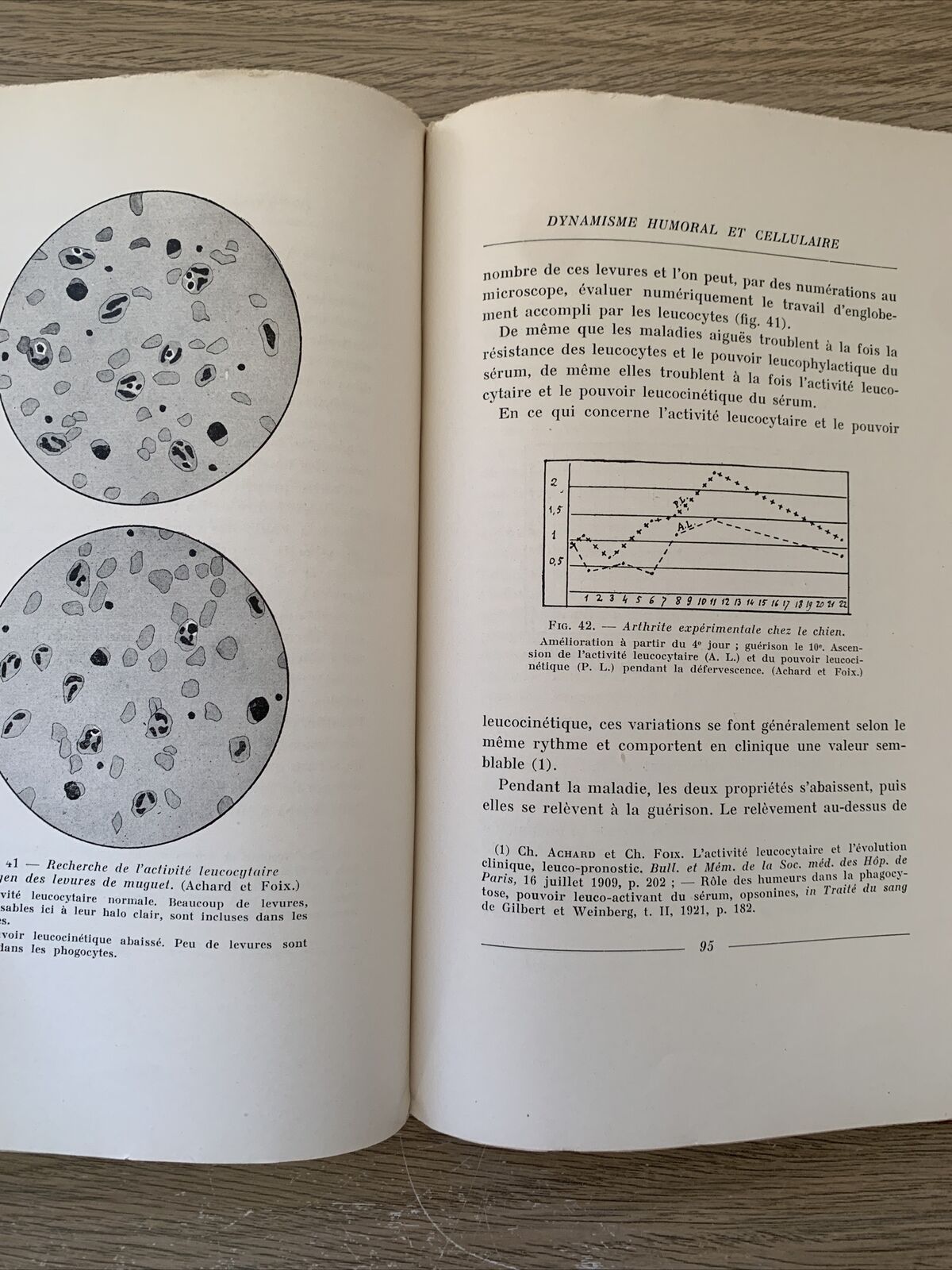 LES CRISES DANS LES MALADIES CYCLIQUES. CHARLES ACHARD. MASSON et CIE 1932