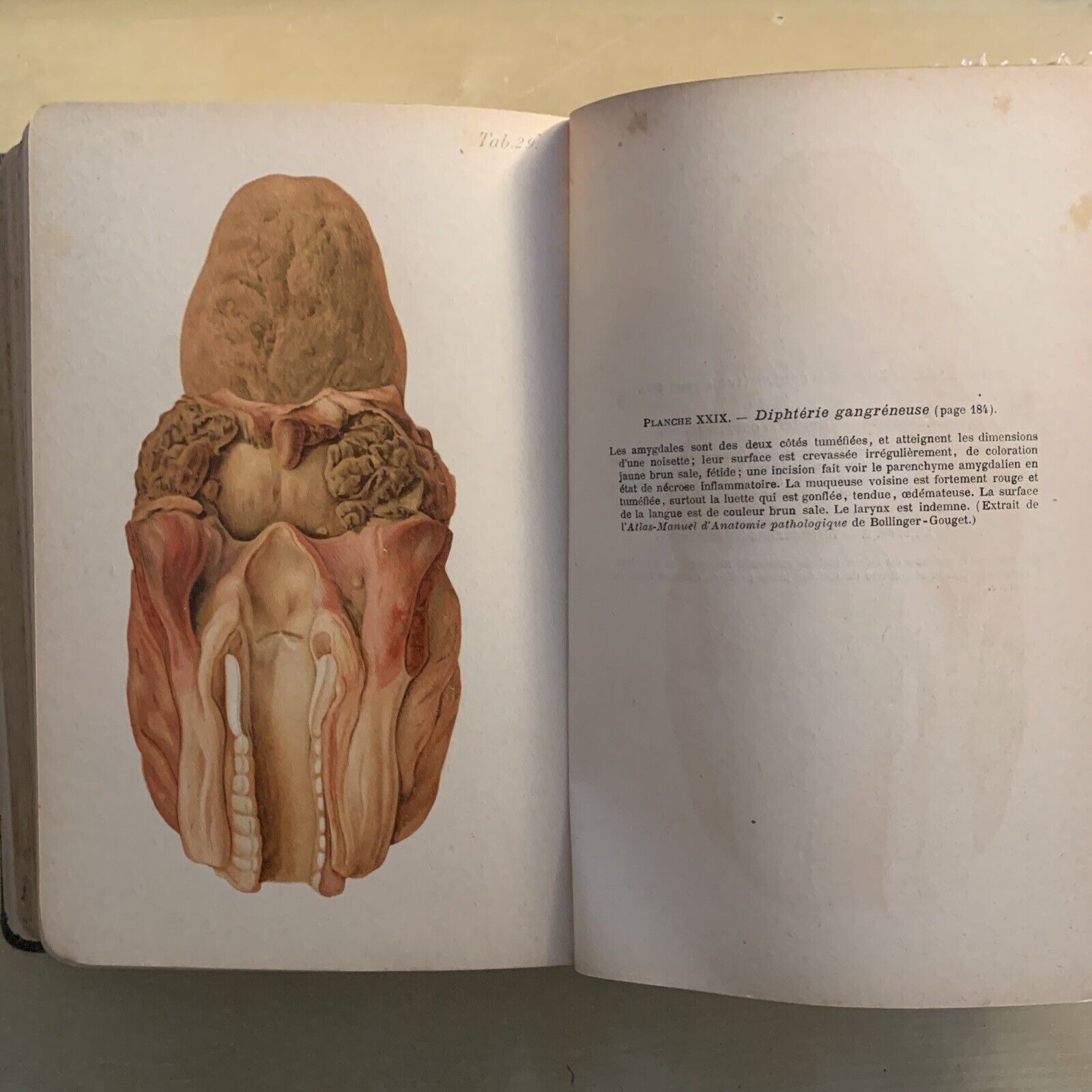 ATLAS MANUEL MALADIES DES ENFANTS. Hecker Trump Apert. Baillière & Fils 1906 #