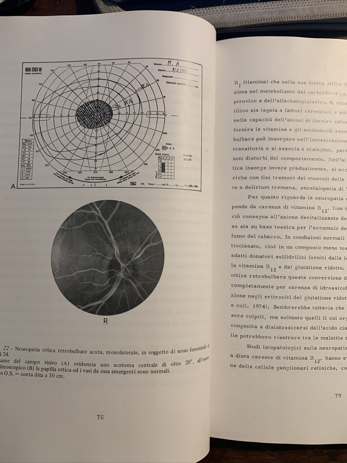 Appunti di Neuroftalmologia. Patologia delle vie ottiche. F. Carta. Vol. 1 #