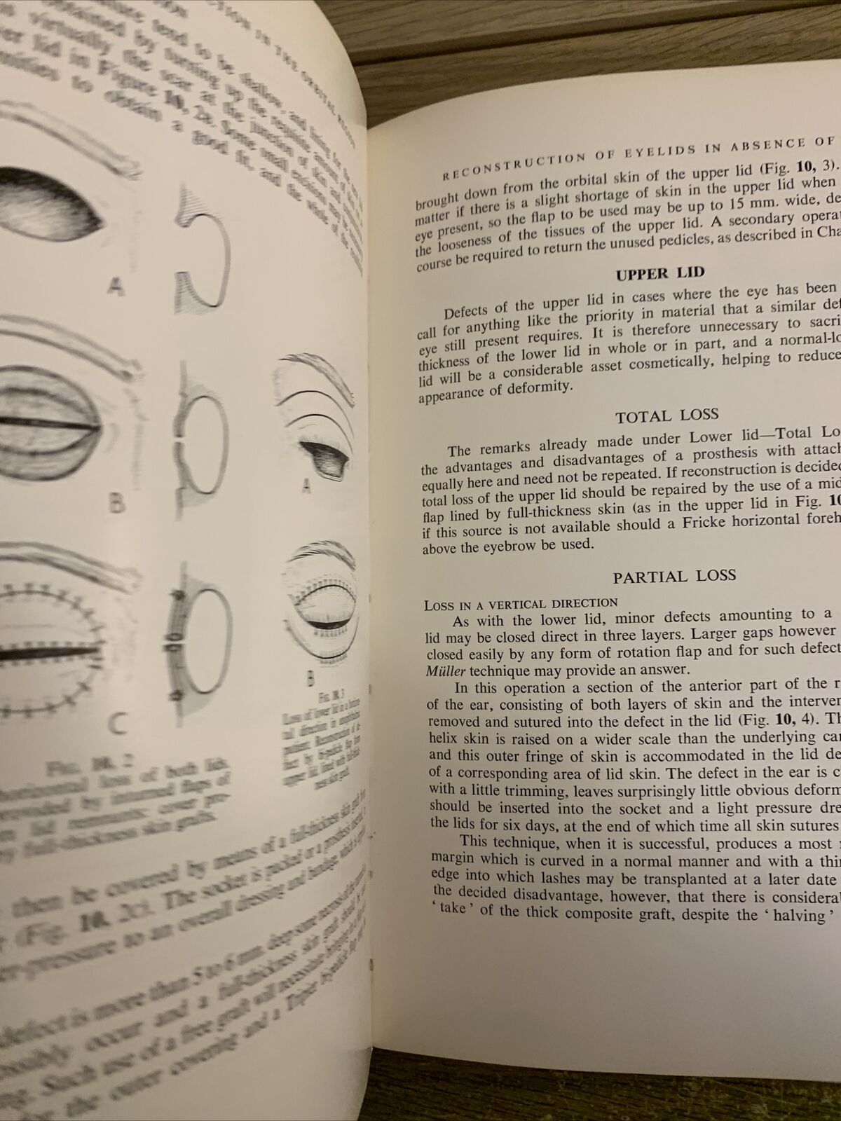 REPAIR AND RECONSTRUCTION IN THE ORBITAL REGION - MUSTARDÉ J. C. Churchill 1971