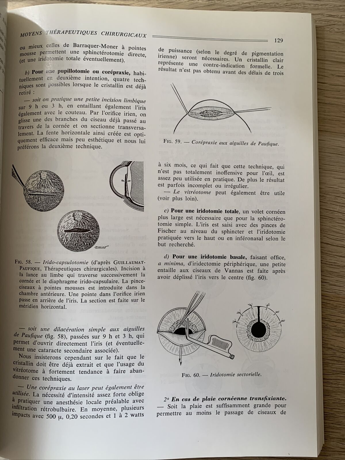 Plaies et contusions du segment anterieur de l'oeil. C. Boudet. Ophtalmologie #