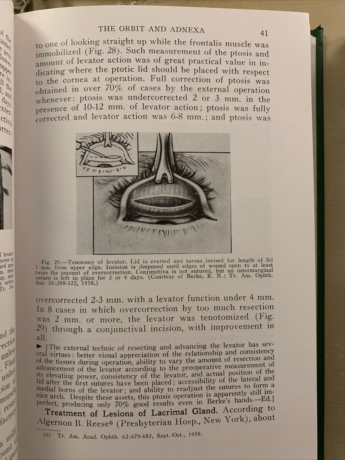 YEAR BOOK OF OPHTALMOLOGY - HUGHES 1965 -1966. 1959 - 1960 #