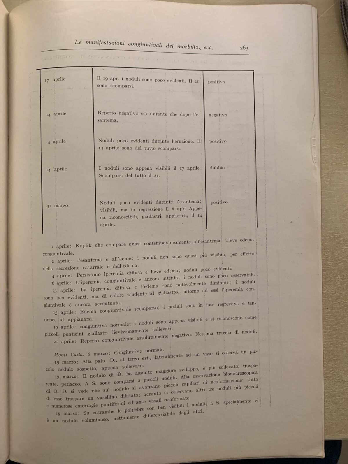 Le manifestazioni congiuntivali del morbillo con riguardo all'incubazione 1935 #