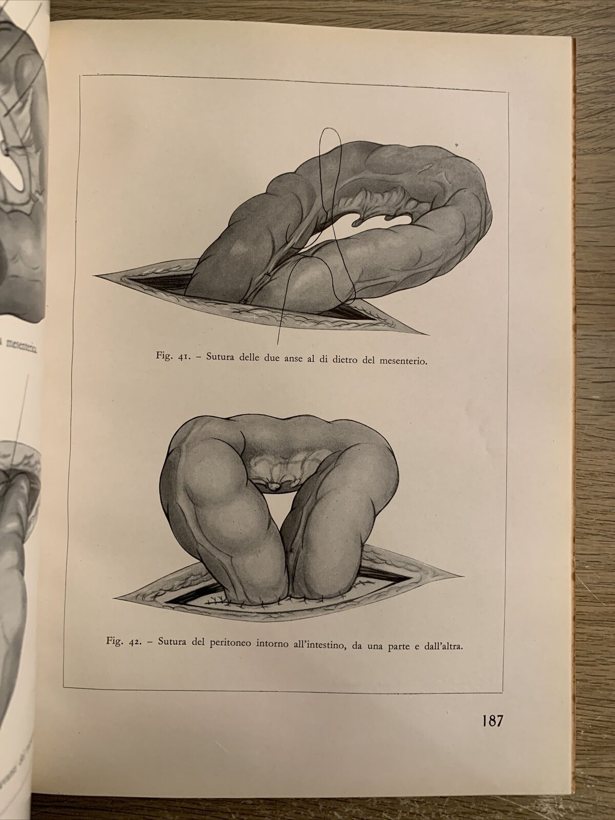 OPERAZIONI CHIRURGICHE. A. CIMINIATA. VOLUME TERZO. HOEPLI 1939