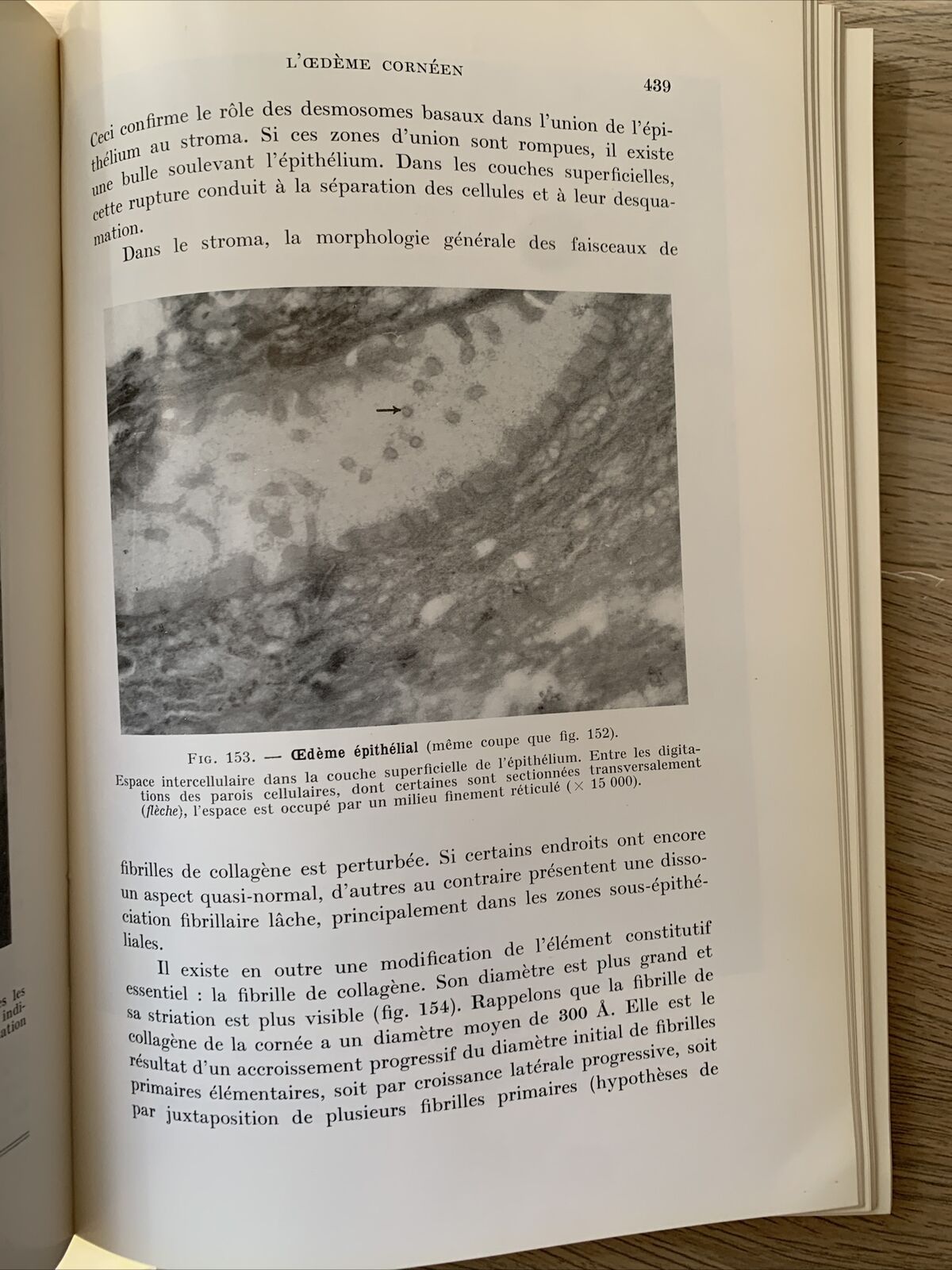 La Transparence de la Cornée, les Mécanismes de ses Altérations. Payrau 1967 #