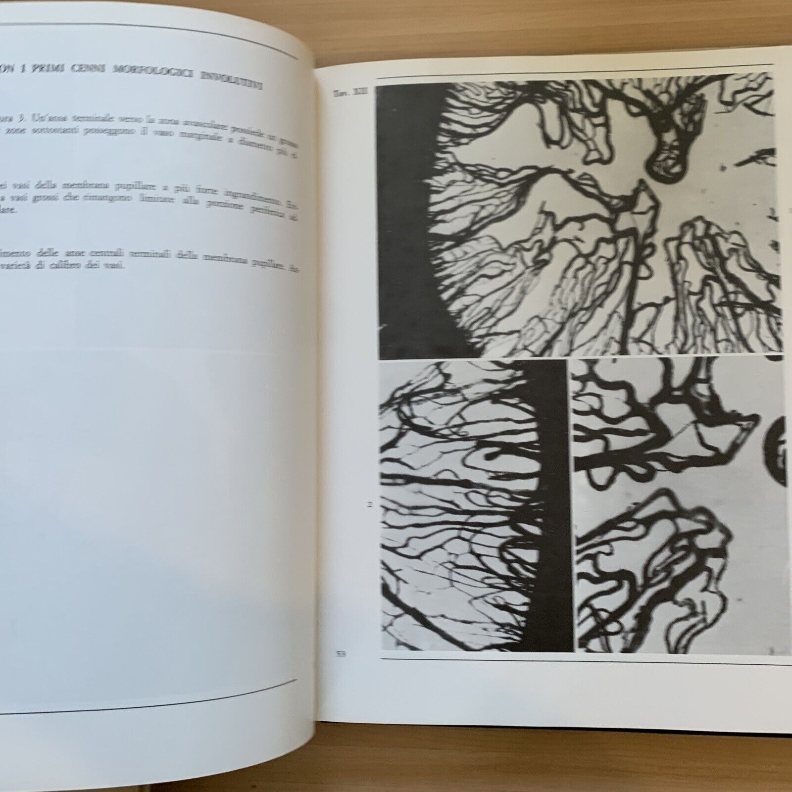 L'OCCHIO - parte terza volume primo. microvascolarizzazione. Morone, Ottaviani