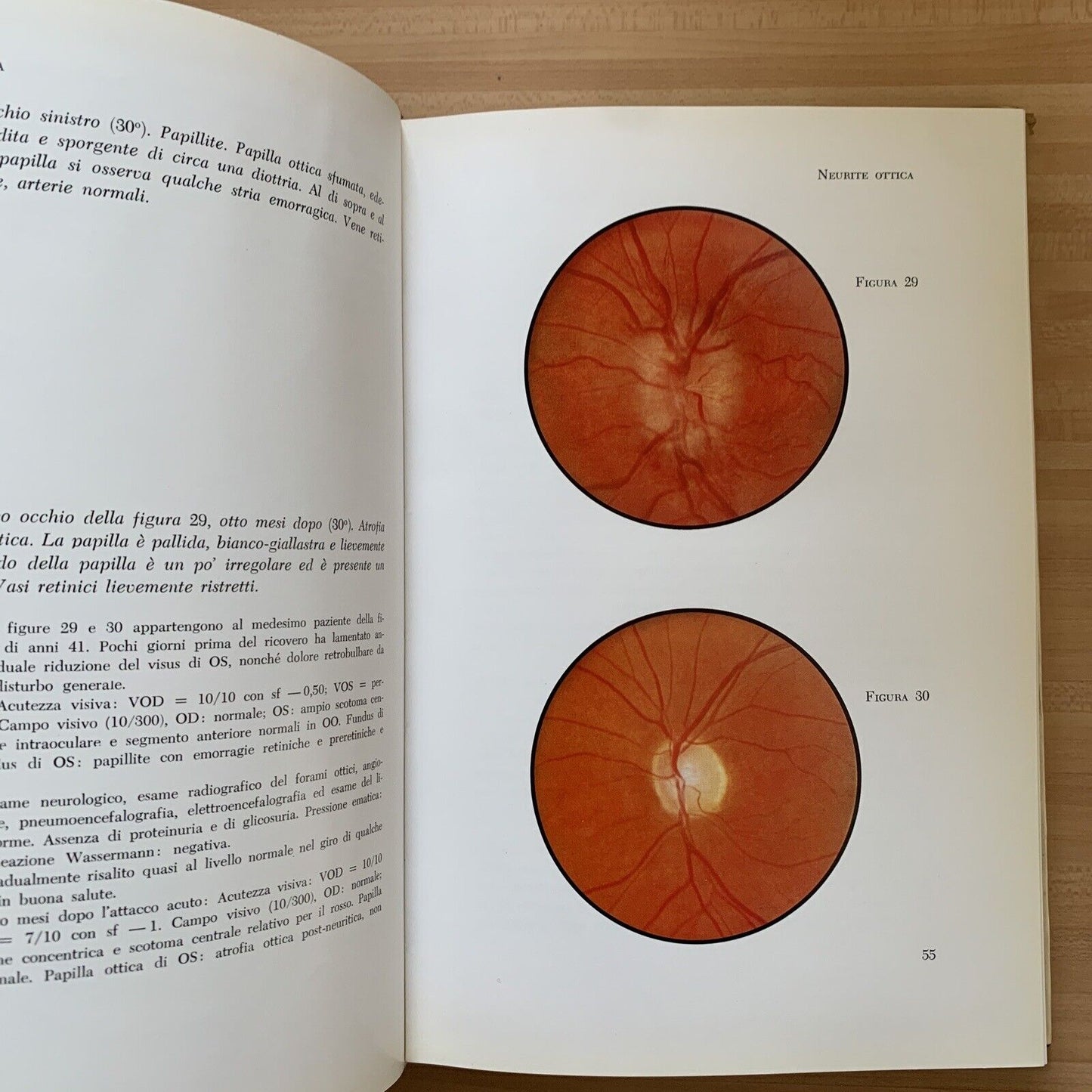 ATLANTE DEL FONDO DELL'OCCHIO - H. W. LARSEN. Luigi Russo editore 1964