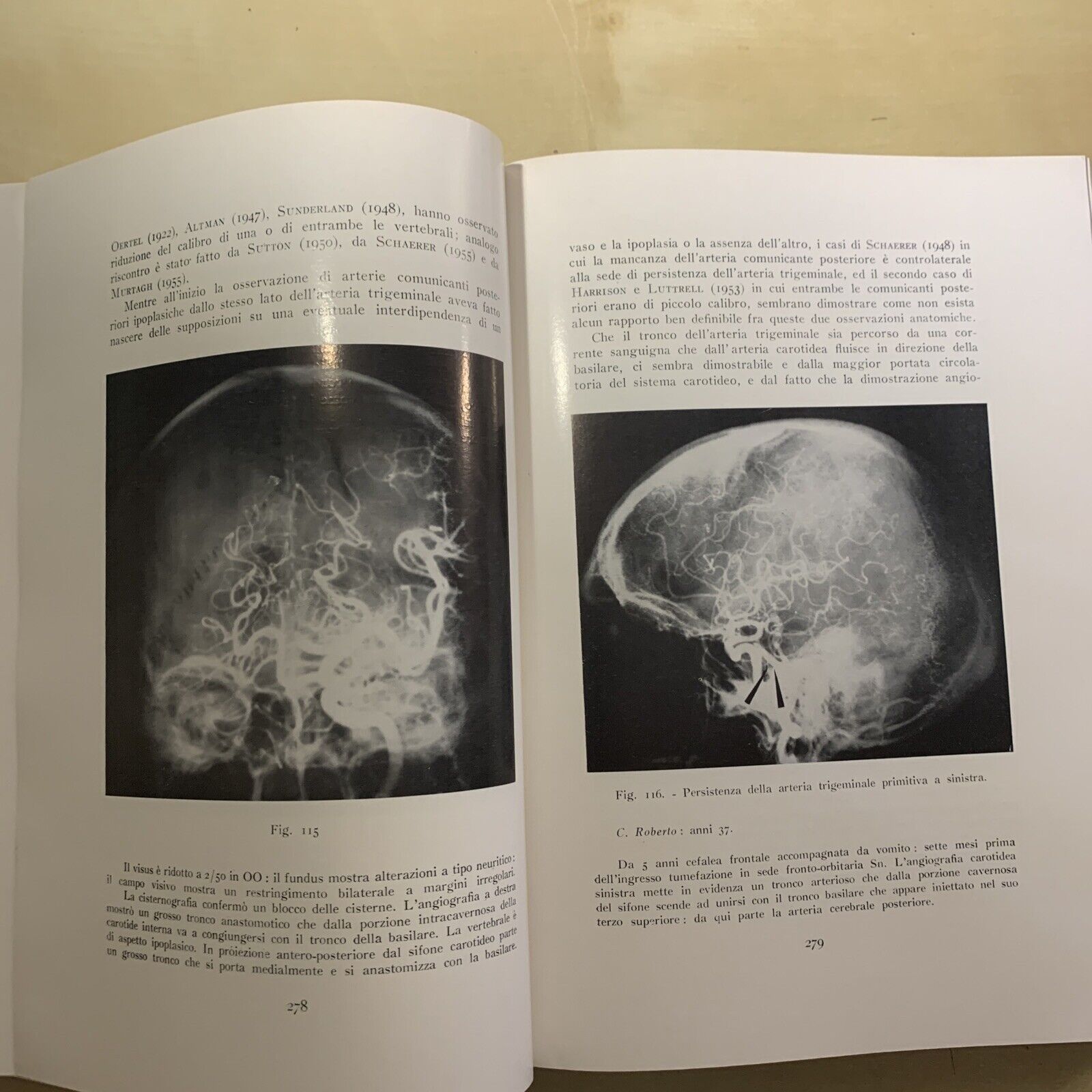 ANGIOGRAFIA CEREBRALE - MARIO MILLETTI, VOLUME PRIMO. LUIGI PARMA 1959