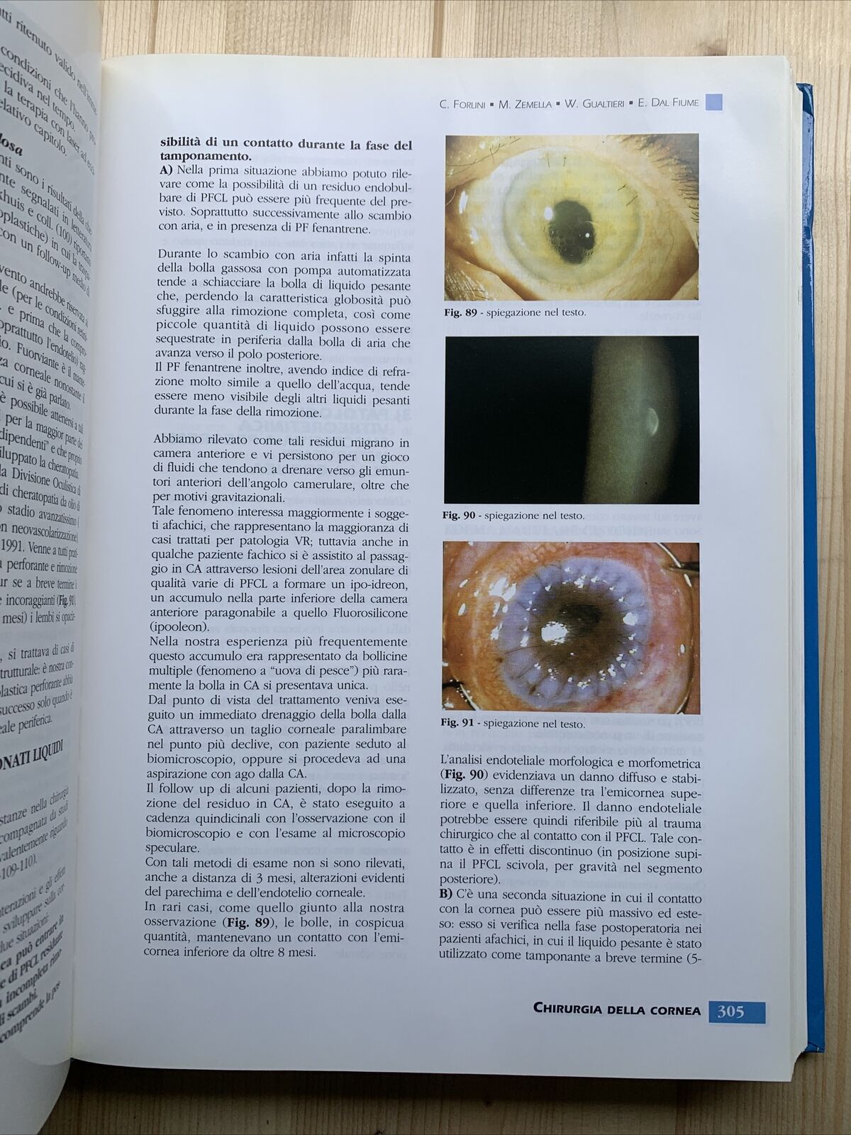 Chirurgia della Cornea - G. Rama, Società Oftalmologica Italiana. Fogliazza #