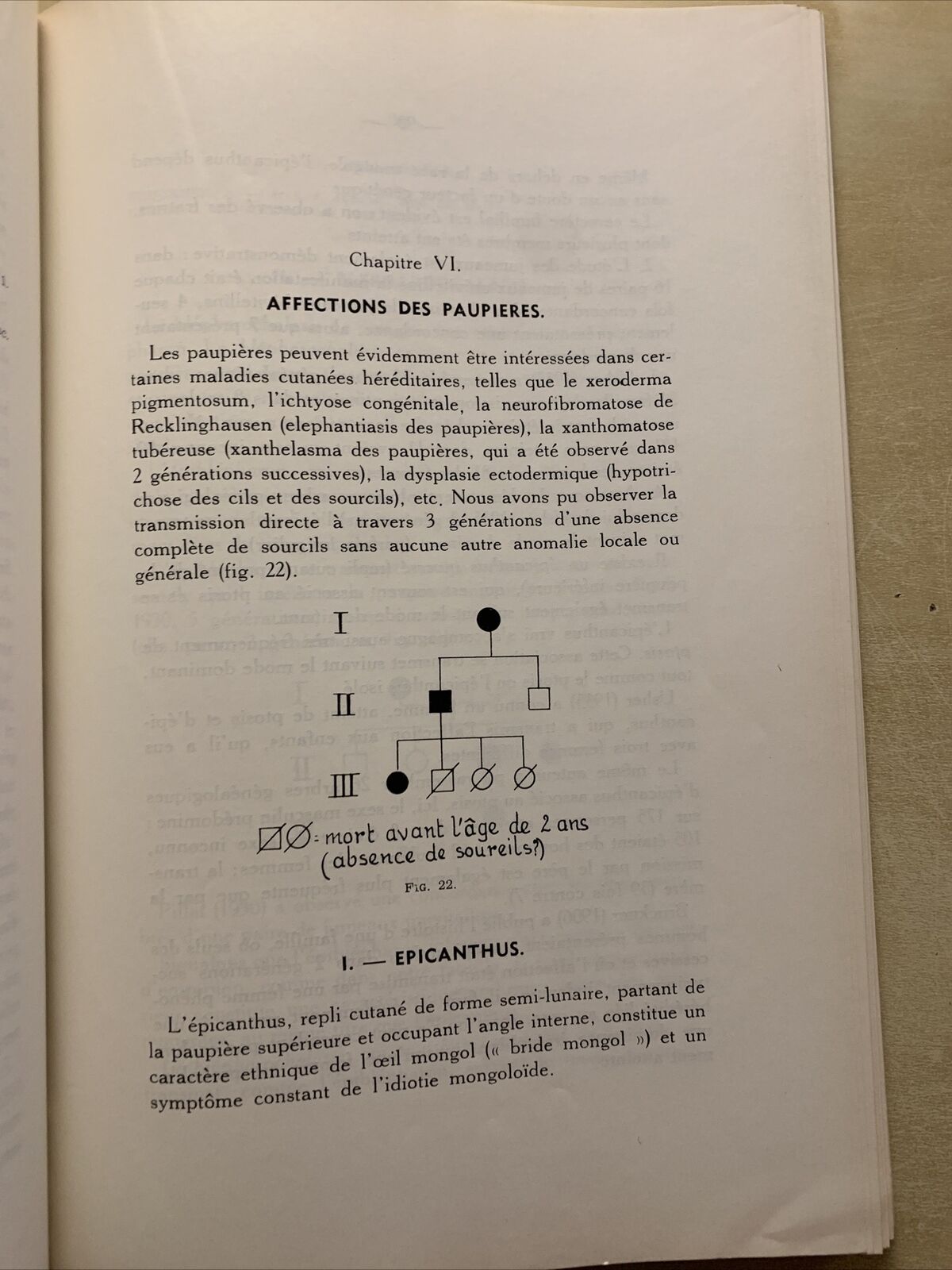 L'Heredite en Ophtalmologie - Jules Francois #