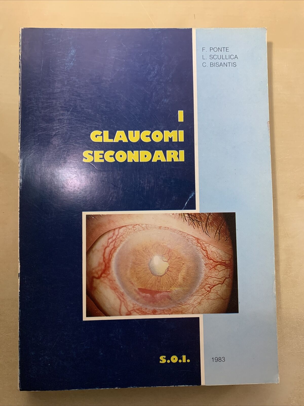 I GLAUCOMI SECONDARI - F. PONTE, SCULLICA, BISANTIS 1983