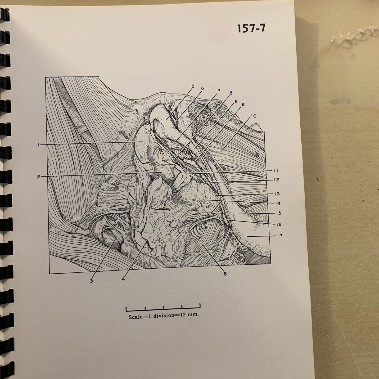 A STEREOSCOPIC ATLAS OF HUMAN ANATOMY - David Bassett section VI The pelvis #