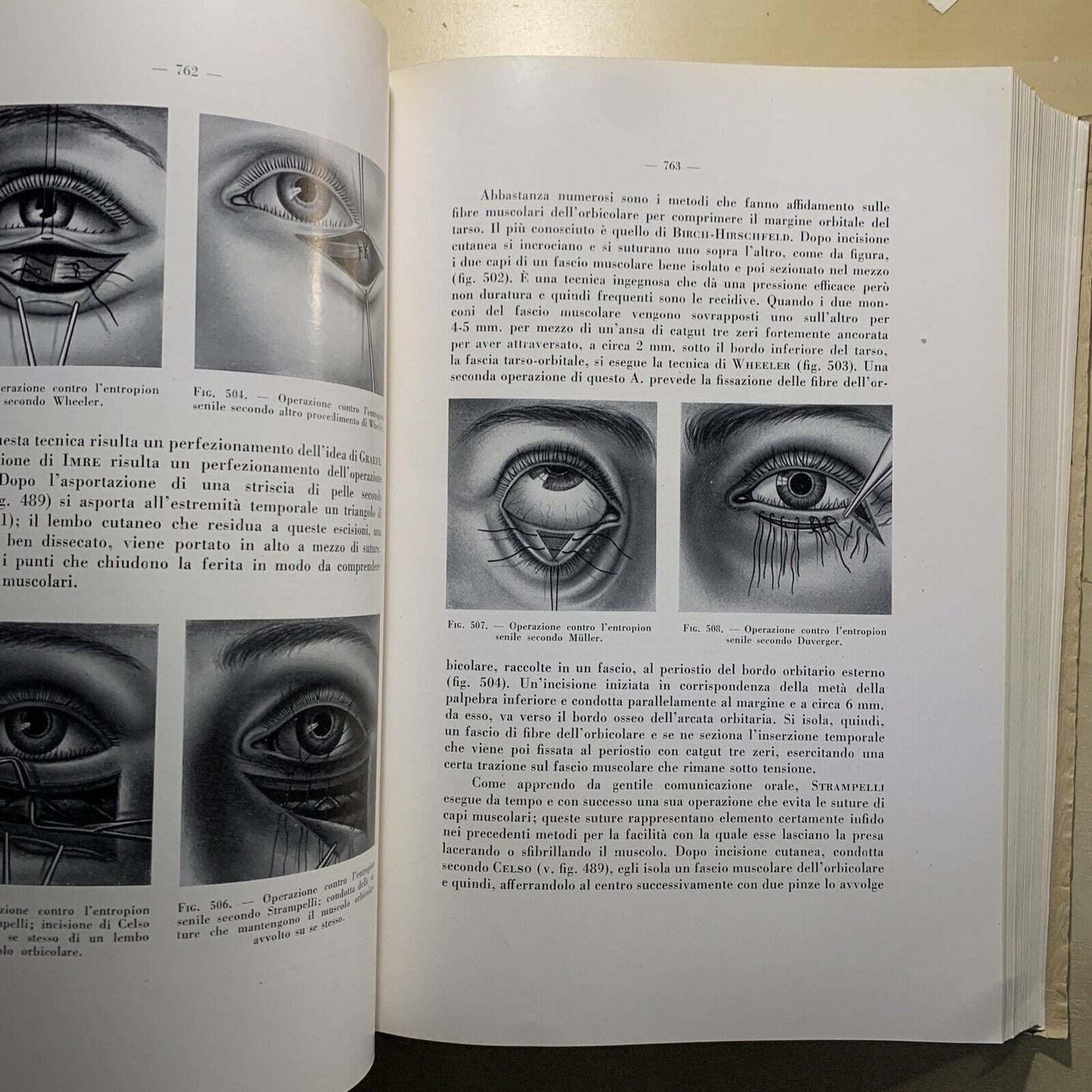 CHIRURGIA DELL'APPARATO OCULARE Volume secondo. E. LEONARDI. ARTE DELLA STAMPA #