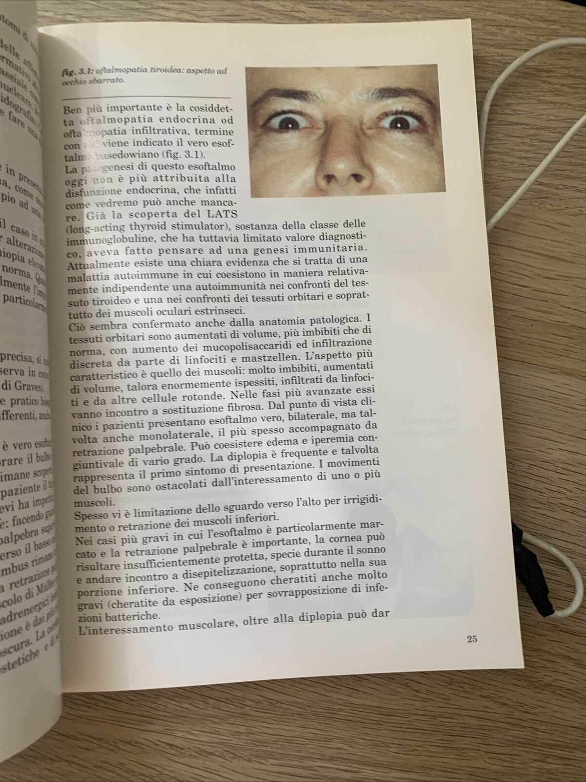 MANUALE PRATICO DI OFTALMOLOGIA - LUCIANO BONOMI, PROGEI EDITORI 1993 #