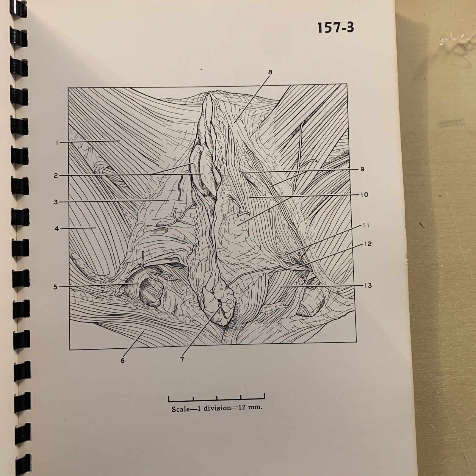 A STEREOSCOPIC ATLAS OF HUMAN ANATOMY - David Bassett section VI The pelvis #