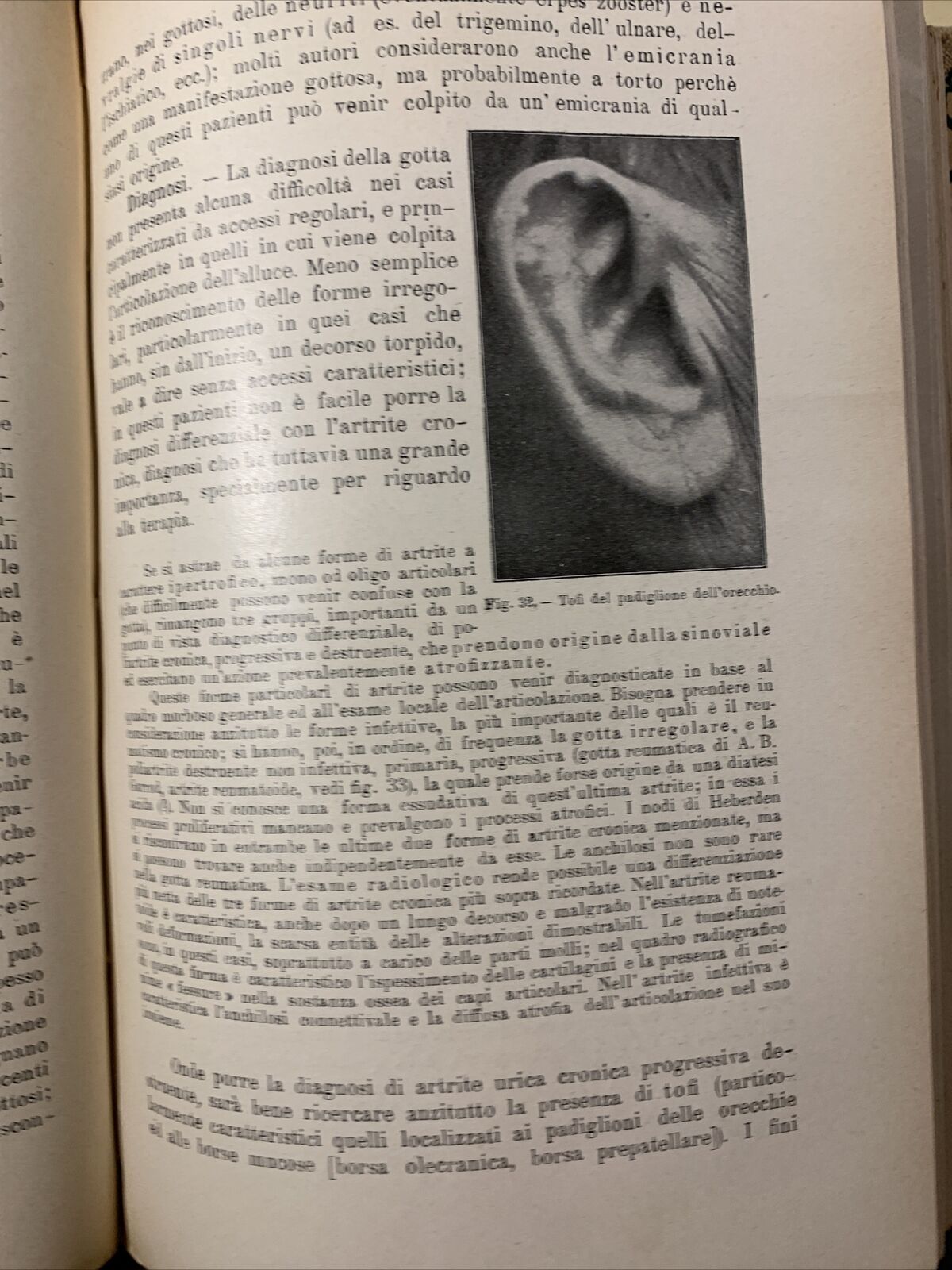 TRATTATO DELLE MALATTIE INTERNE, J. v. Mering. Società Editrice Libraria 1926
