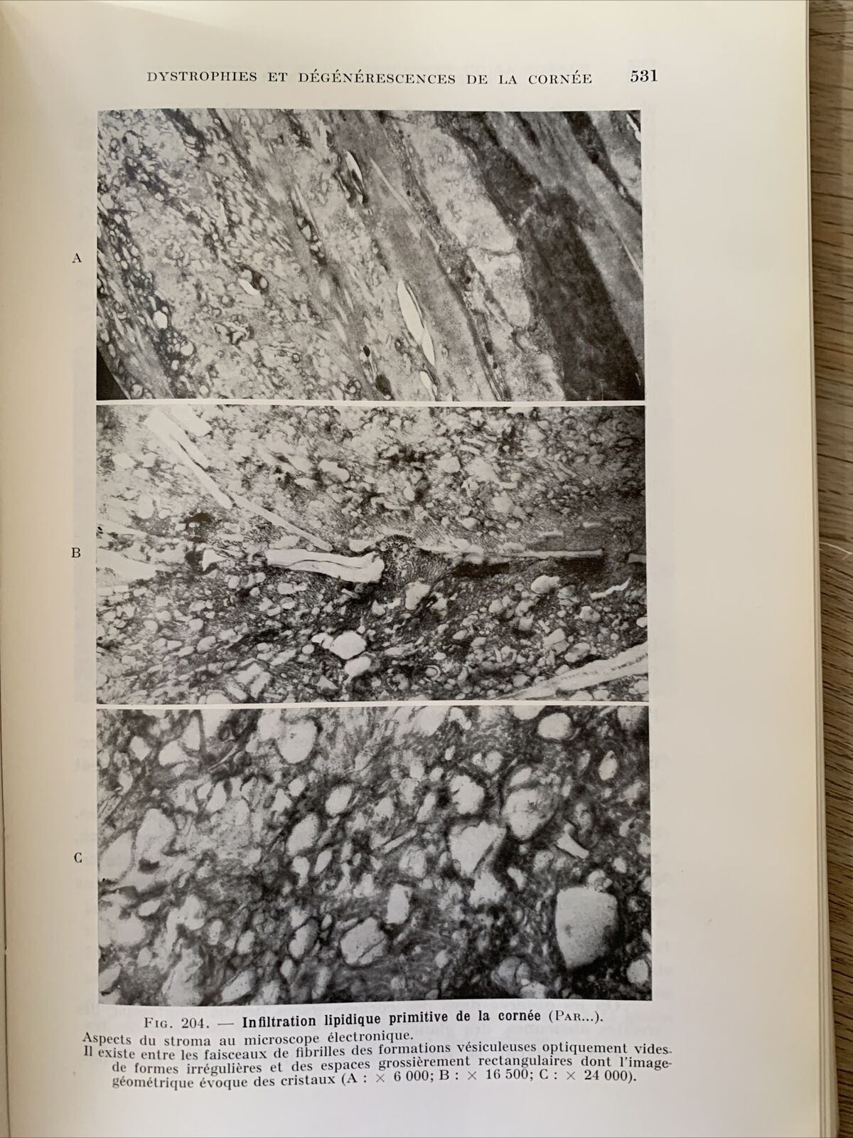 La Transparence de la Cornée, les Mécanismes de ses Altérations. Payrau 1967 #
