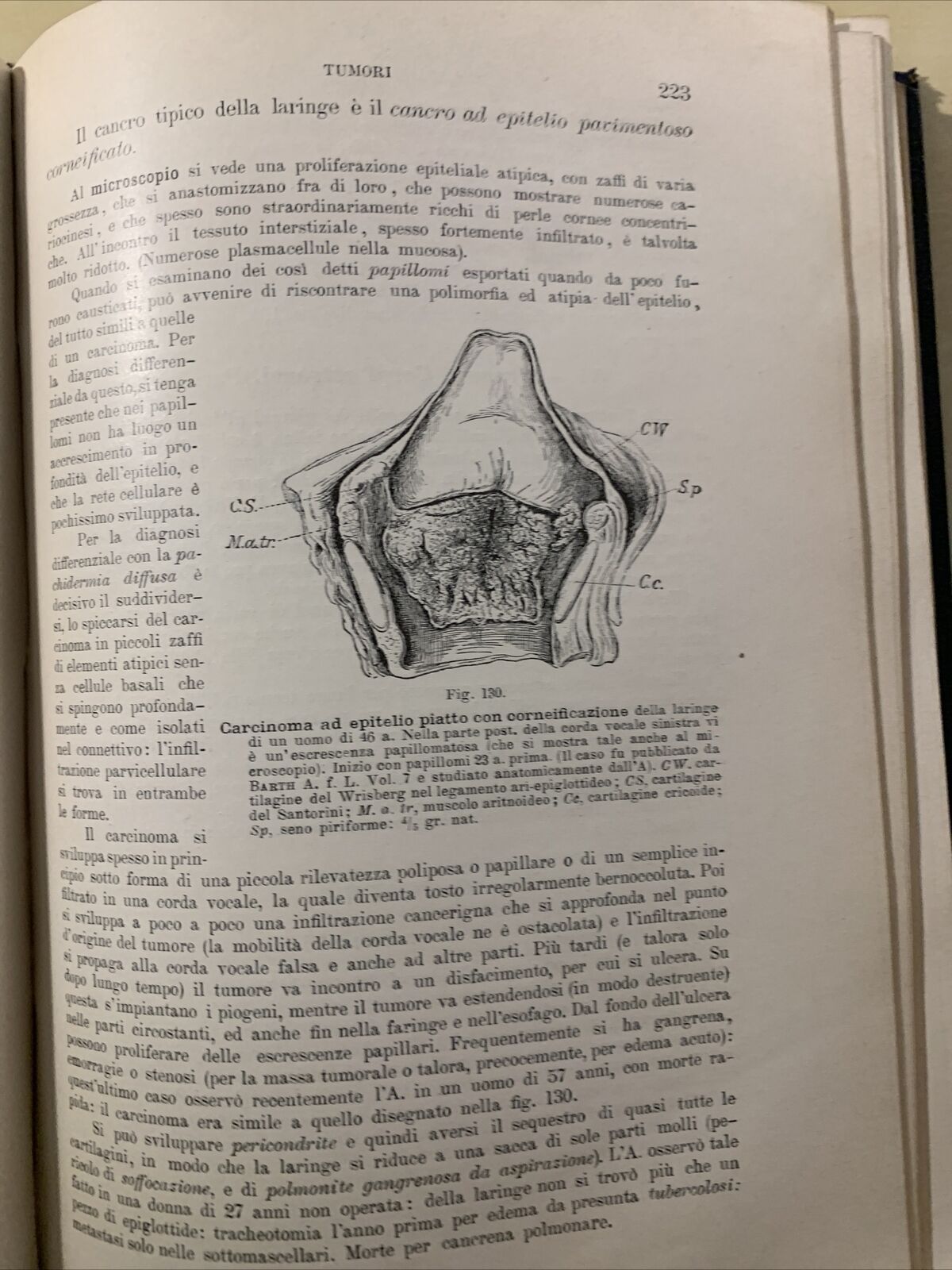 Trattato di ANATOMIA PATOLOGICA SPECIALE - Kaufmann E. Vallardi 1913 2 voll. #