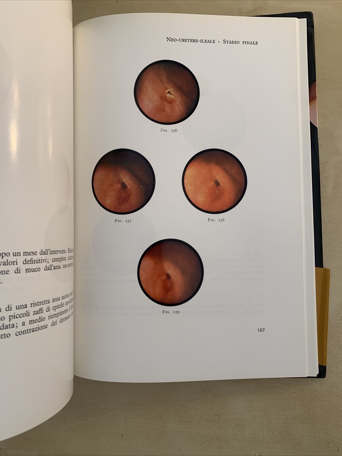 UROLOGIA ENDOSCOPICA - Rocca Rossetti, Usai, Binaghi. Editrice Universo 1970 #