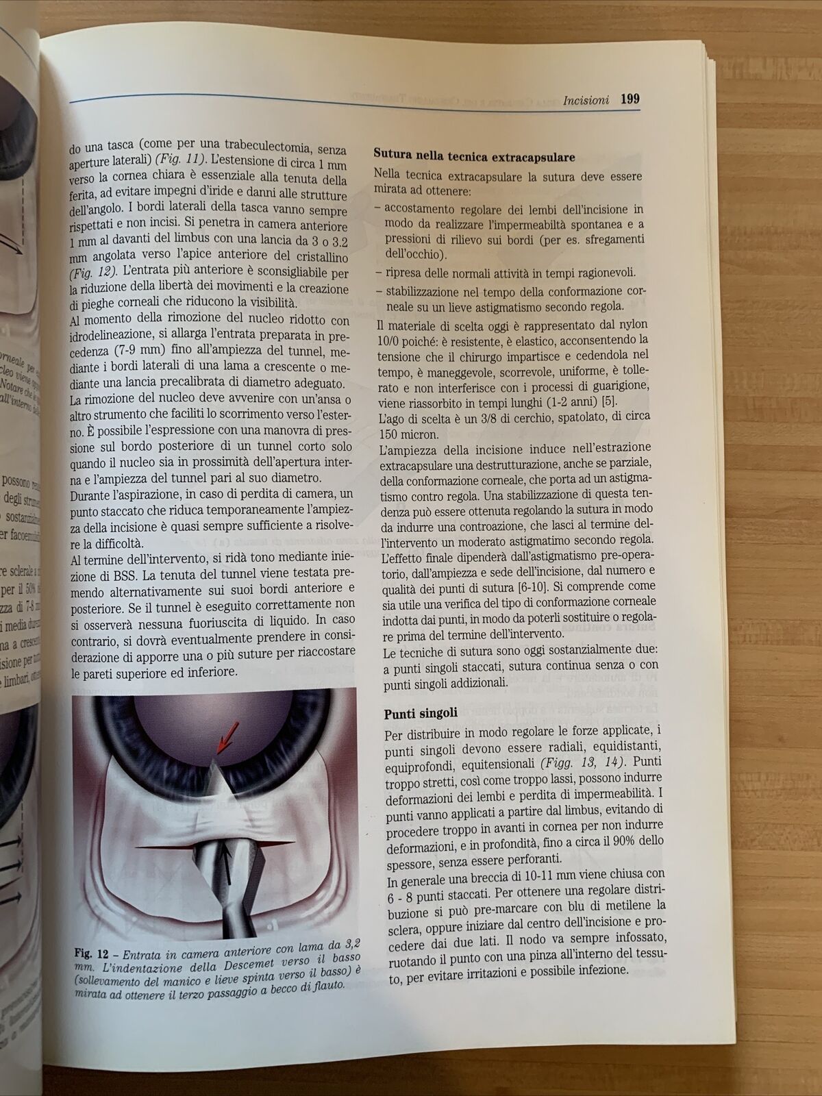 CATARATTA fisiopatologia del cristallino chirurgia della Cataratta.Fabiano 1999