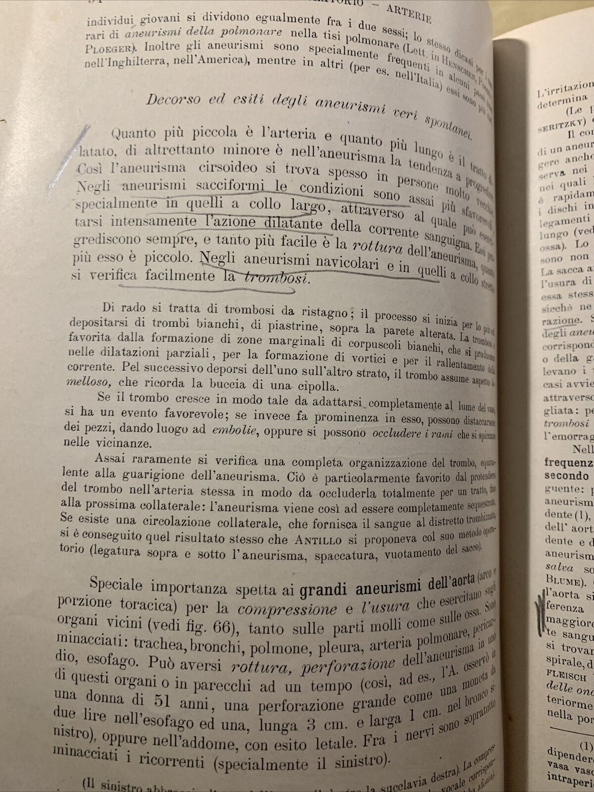 Trattato di ANATOMIA PATOLOGICA SPECIALE - Kaufmann E. Vallardi 1913 2 voll. #