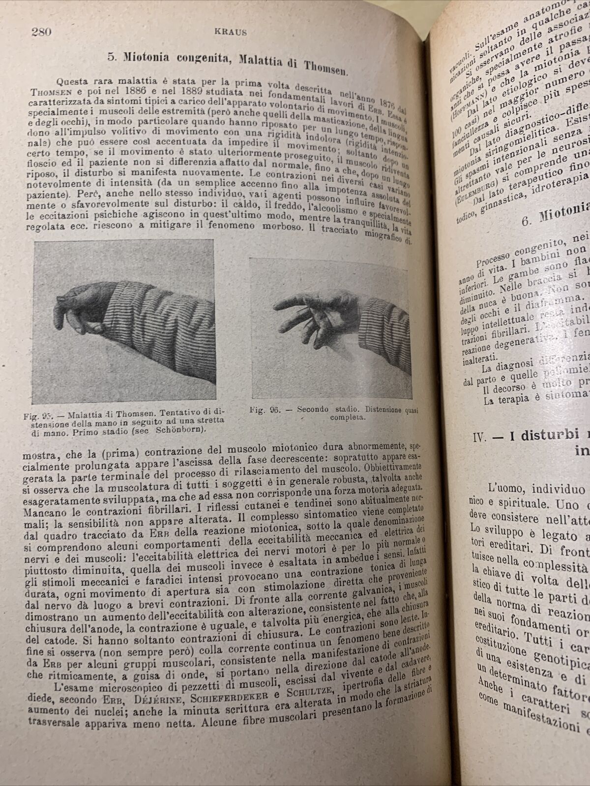 TRATTATO DELLE MALATTIE INTERNE, J. v. Mering. Società Editrice Libraria 1926