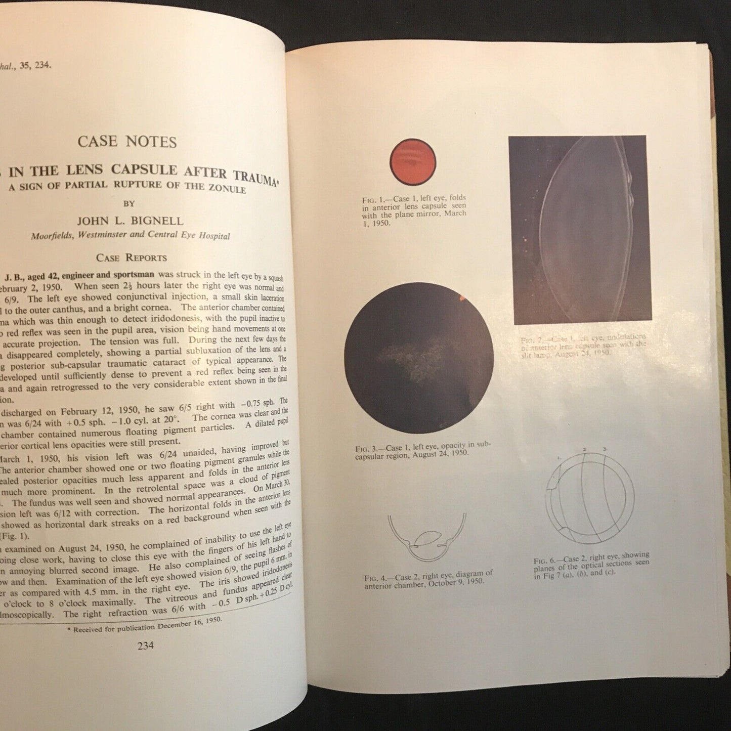 BRITISH JOURNAL OF OPHTHALMOLOGY, oftalmologia. Stewart Duke-Elder 1951 vol XXXV