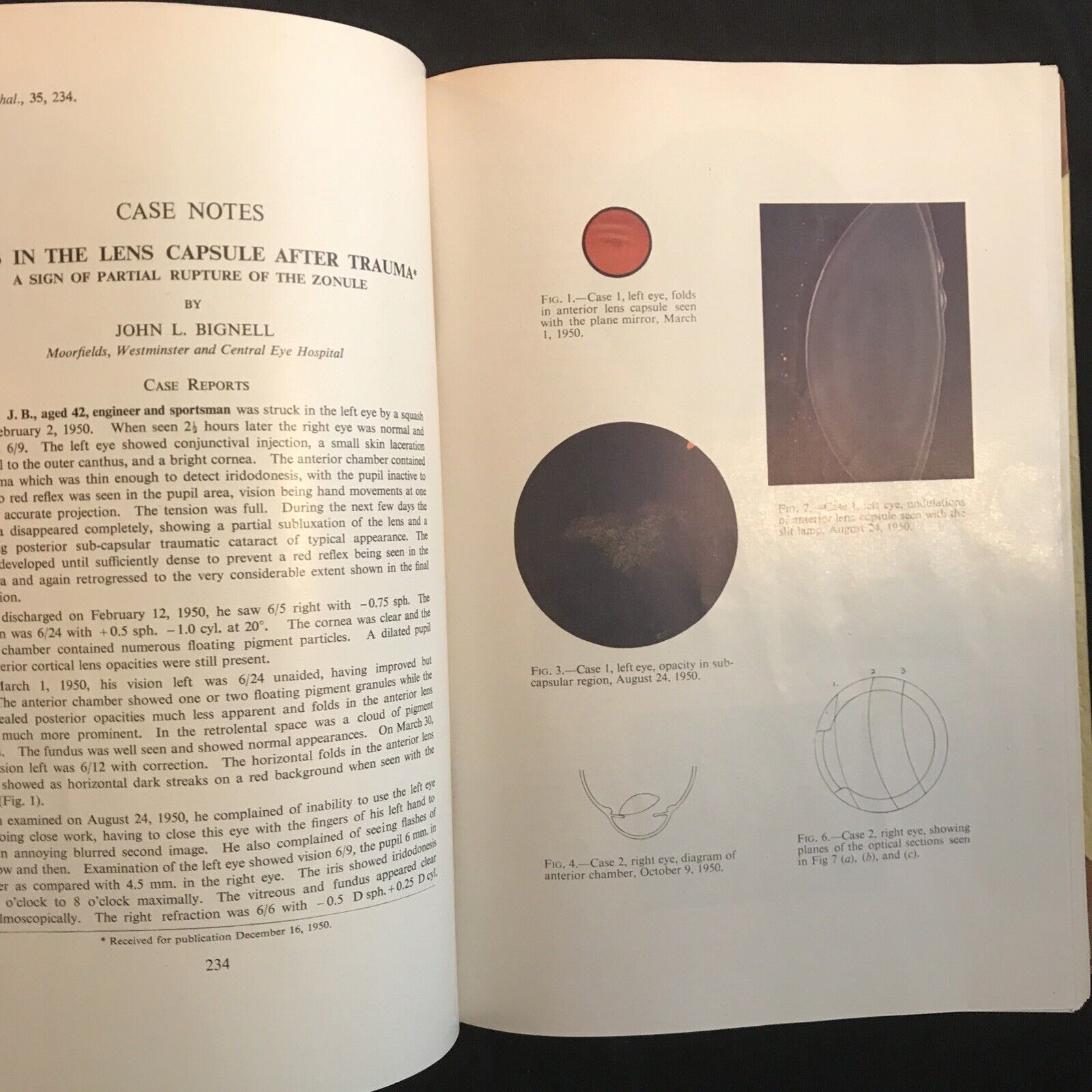 BRITISH JOURNAL OF OPHTHALMOLOGY, oftalmologia. Stewart Duke-Elder 1951 vol XXXV