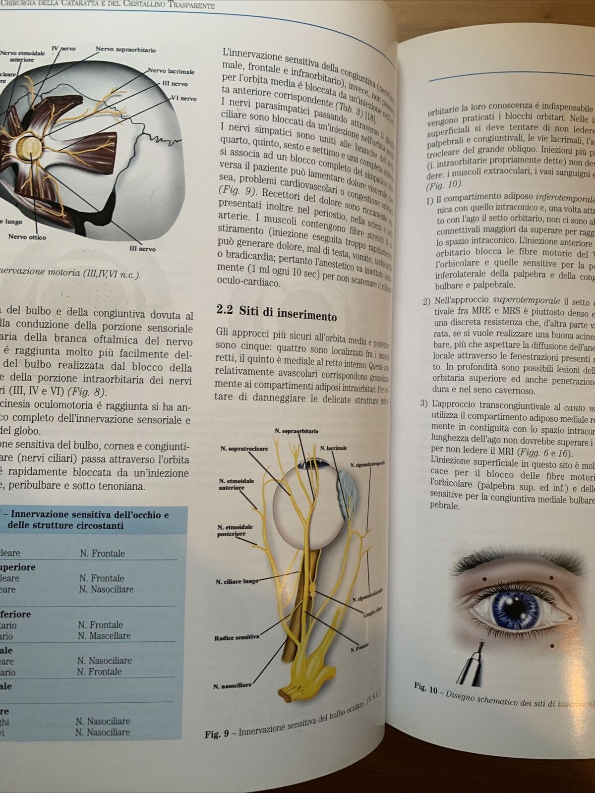 CATARATTA fisiopatologia del cristallino chirurgia della Cataratta.Fabiano 1999